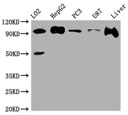 Western Blot. Positive WB detected in: L02 whole cell lysate, HepG2 whole cell lysate, PC-3 whole cell lysate, U-87 whole cell lysate, Rat Liver whole cell lysate. All lanes: ALIX antibody at 1:1000. Secondary. Goat polyclonal to rabbit IgG at 1/50000 dilution. Predicted band size: 97, 97, 31 kDa. Observed band size: 97 kDa. 