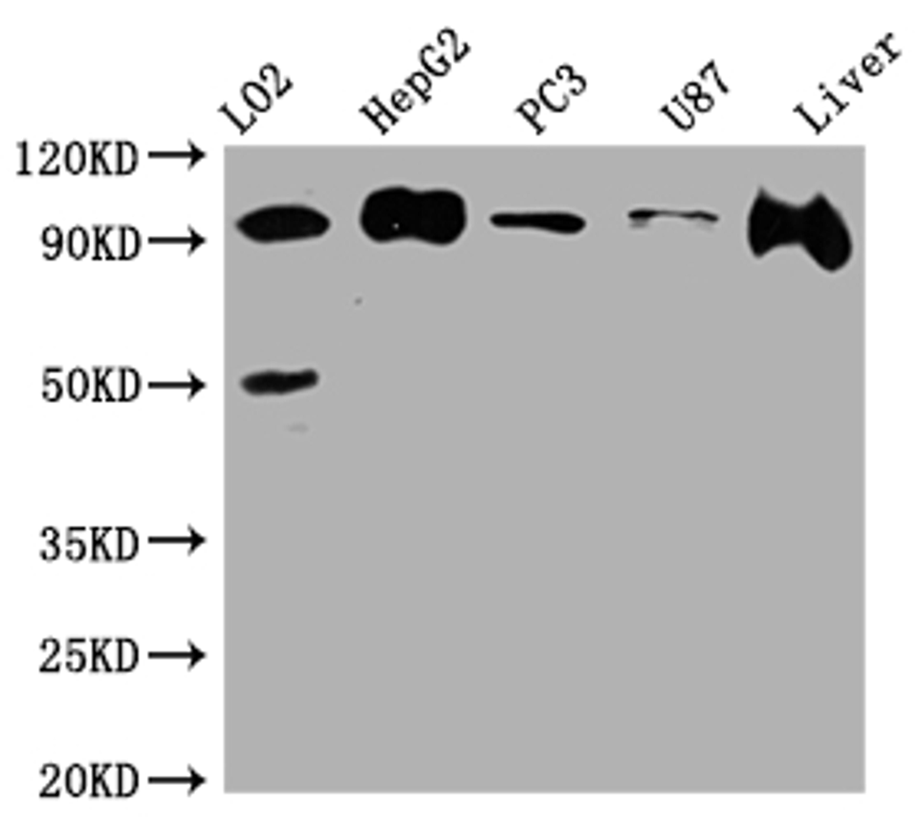 Western Blot. Positive WB detected in: L02 whole cell lysate, HepG2 whole cell lysate, PC-3 whole cell lysate, U-87 whole cell lysate, Rat Liver whole cell lysate. All lanes: ALIX antibody at 1:1000. Secondary. Goat polyclonal to rabbit IgG at 1/50000 dilution. Predicted band size: 97, 97, 31 kDa. Observed band size: 97 kDa. 
