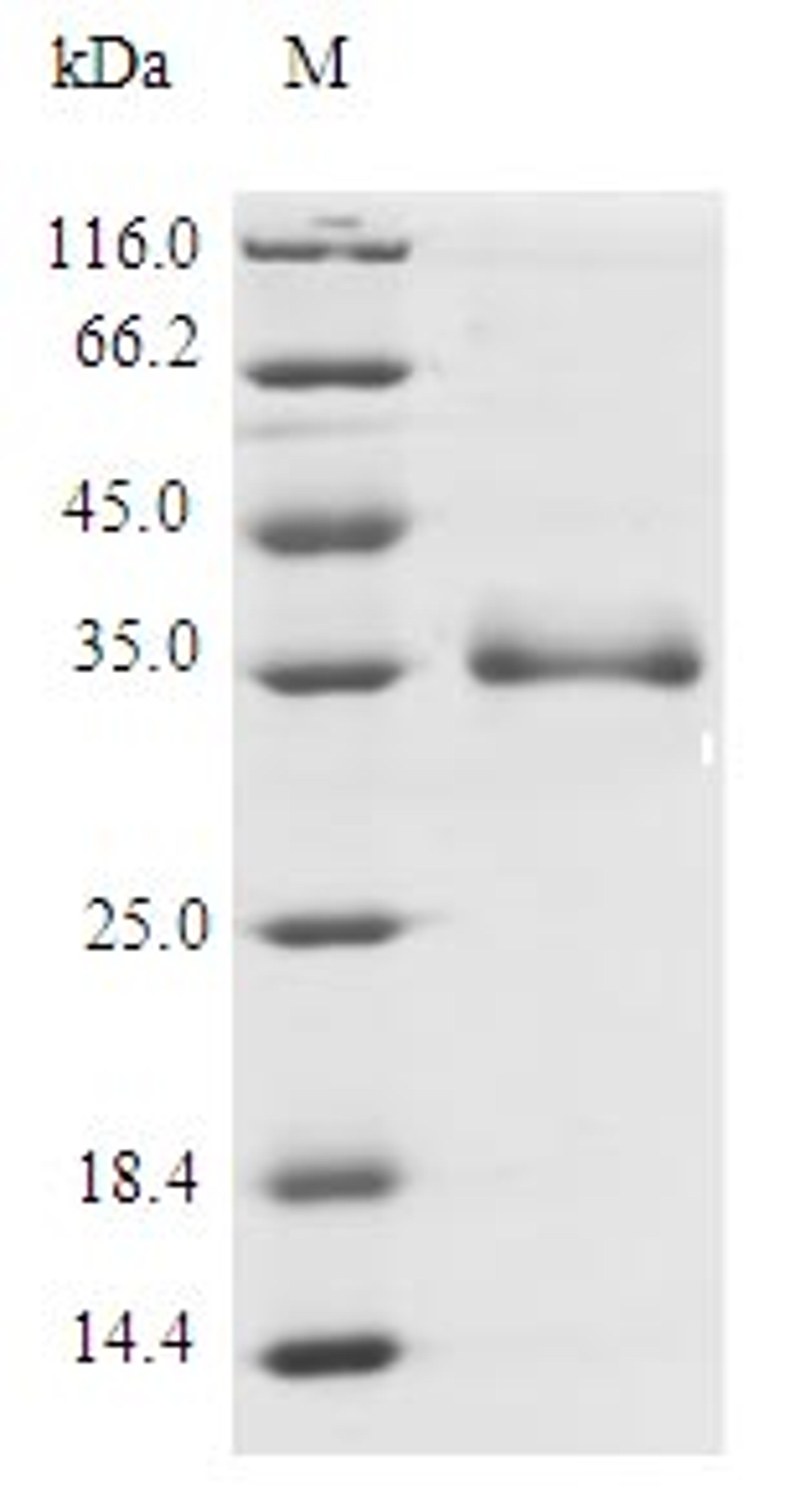 (Tris-Glycine gel) Discontinuous SDS-PAGE (reduced) with 5% enrichment gel and 15% separation gel.