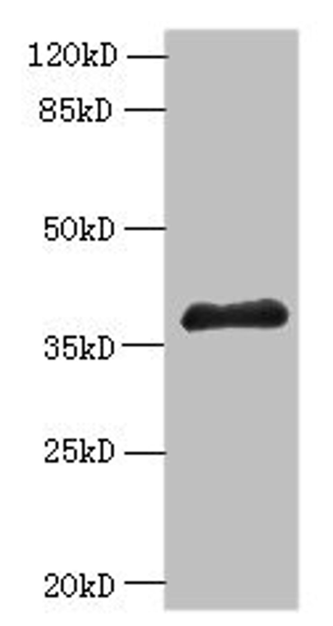 Western blot. All lanes: ELAVL1 antibody at 6µg/ml + A431 whole cell lysate. Secondary. Goat polyclonal to rabbit IgG at 1/10000 dilution. Predicted band size: 37, 39 kDa. Observed band size: 37 kDa