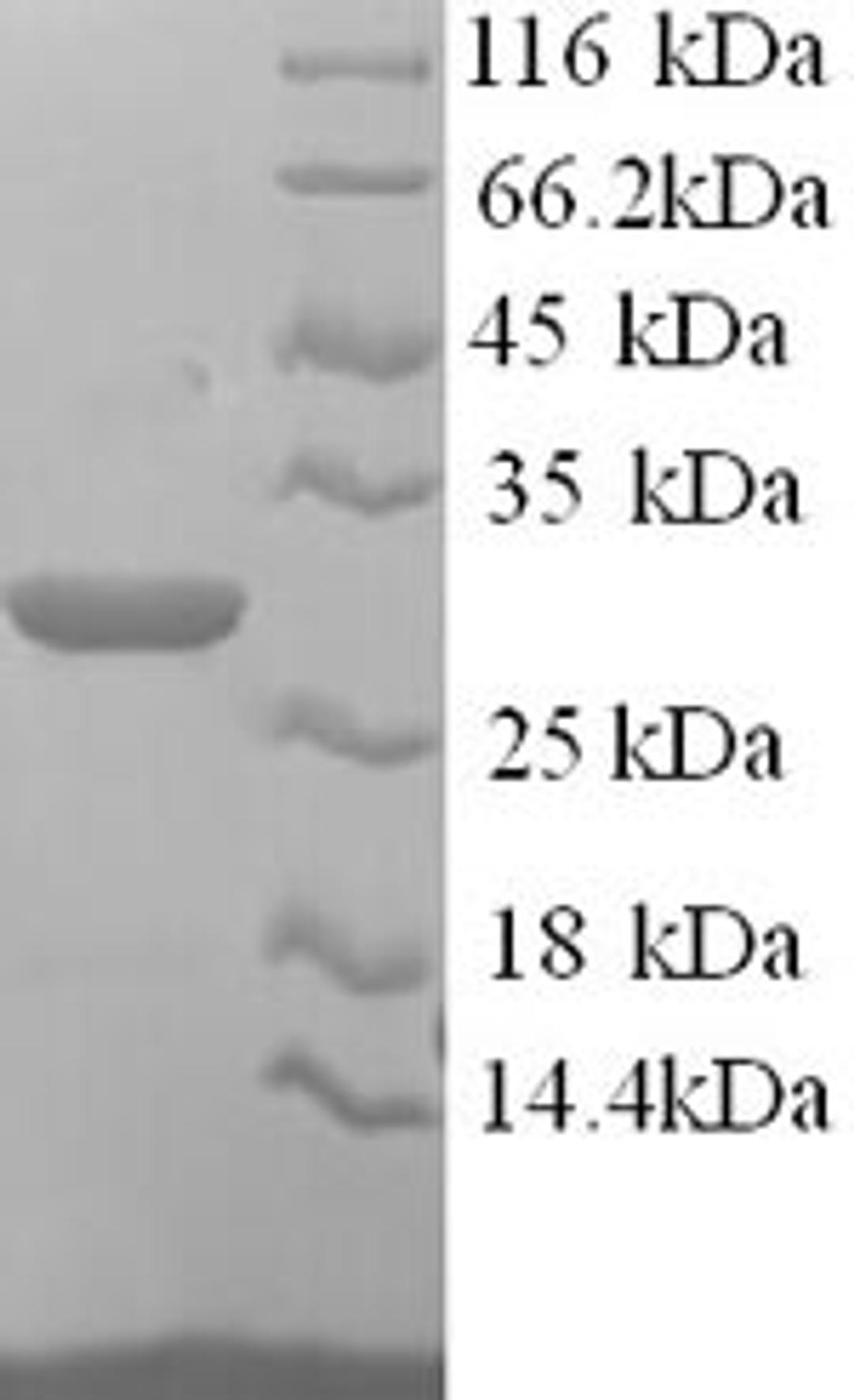 (Tris-Glycine gel) Discontinuous SDS-PAGE (reduced) with 5% enrichment gel and 15% separation gel.