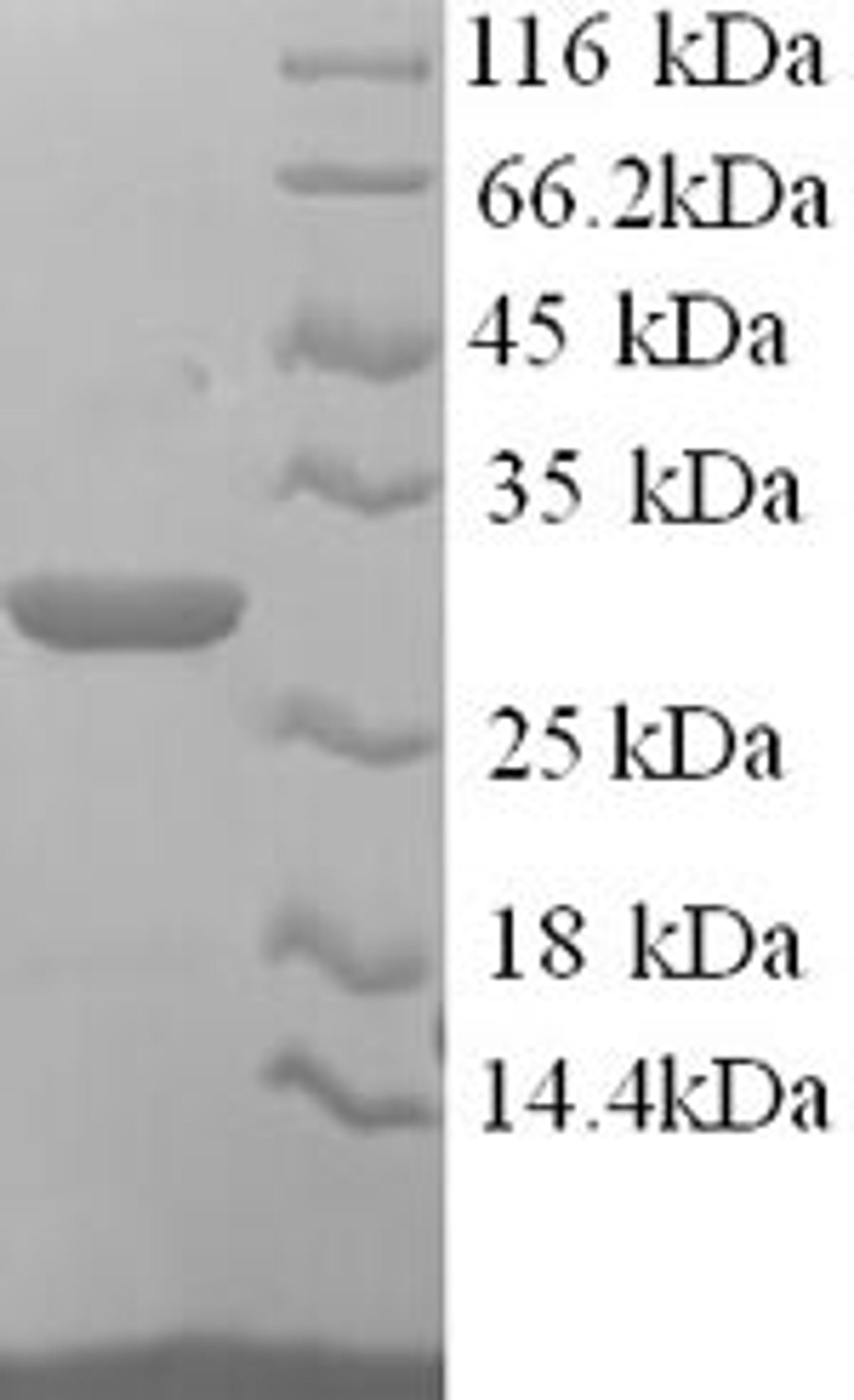 (Tris-Glycine gel) Discontinuous SDS-PAGE (reduced) with 5% enrichment gel and 15% separation gel.