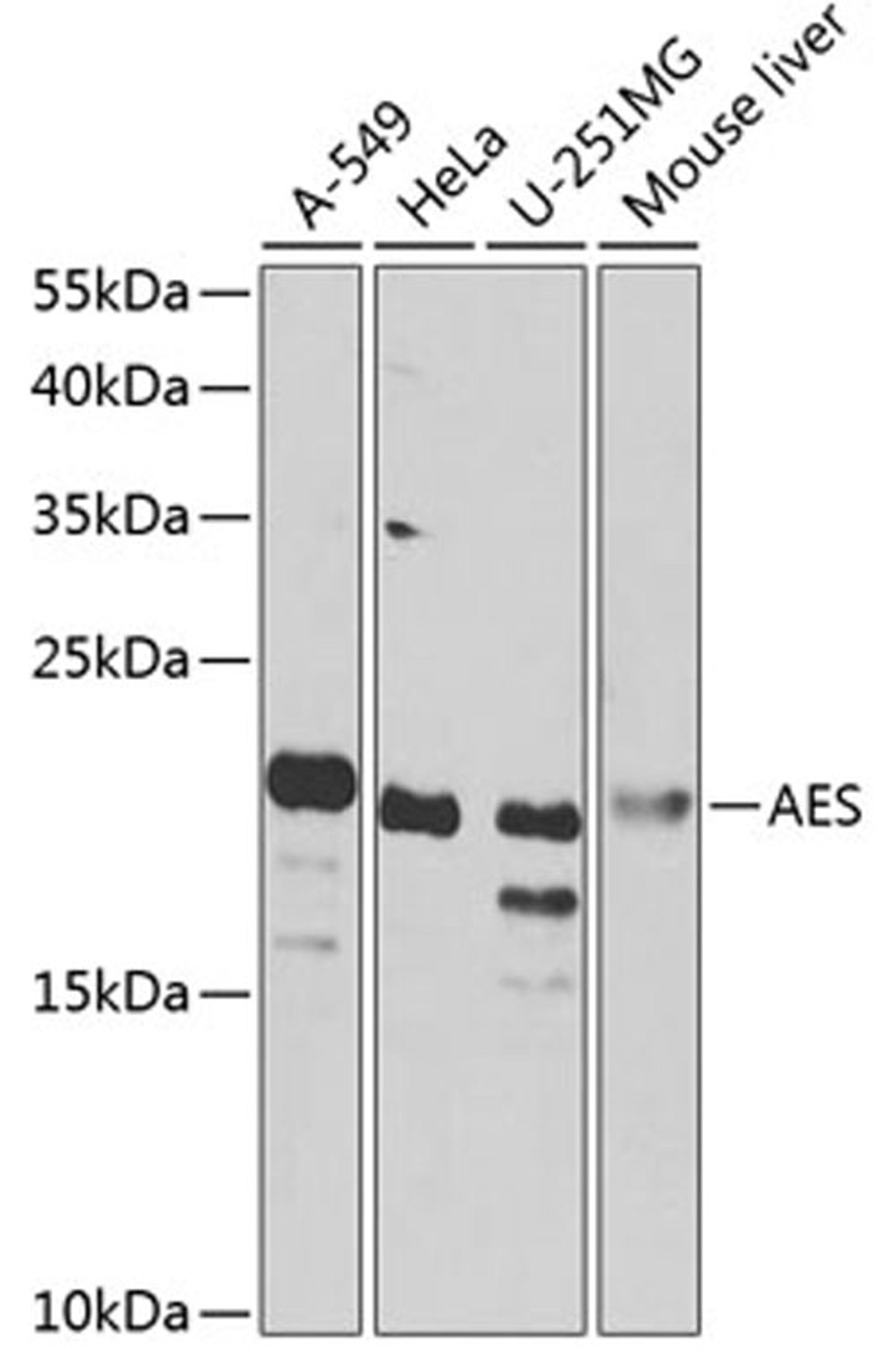 Western blot - AES antibody (A7874)