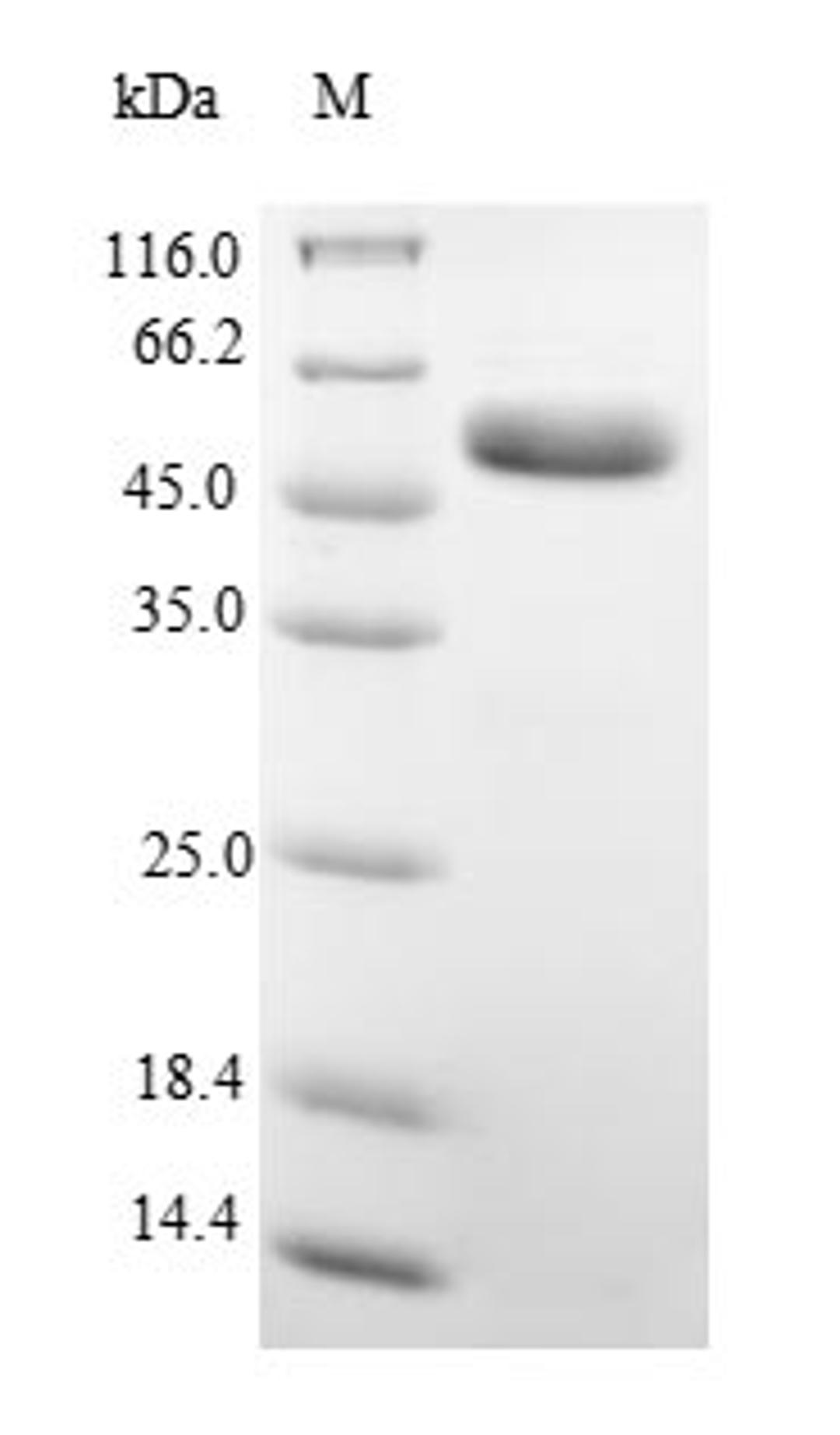 (Tris-Glycine gel) Discontinuous SDS-PAGE (reduced) with 5% enrichment gel and 15% separation gel.