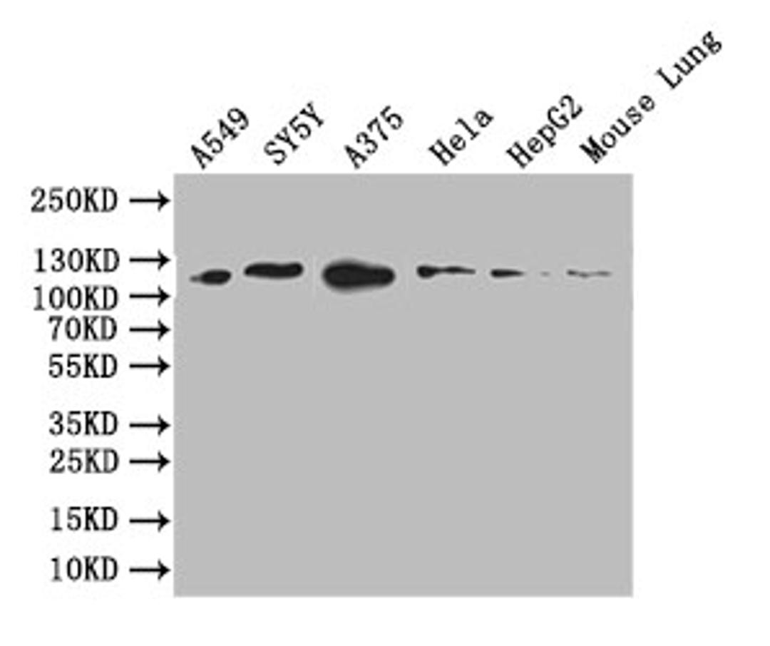 Western Blot. Positive WB detected in: A549 whole cell lysate, SY5Y whole cell lysate, A375 whole cell lysate, HEPG2 whole cell lysate, Mouse Lung tissue lysate. All lanes: DDR2 antibody at 1:1000. Secondary. Goat polyclonal to rabbit IgG at 1/50000 dilution. Predicted band size: 96 kDa. Observed band size: 110 kDa. 