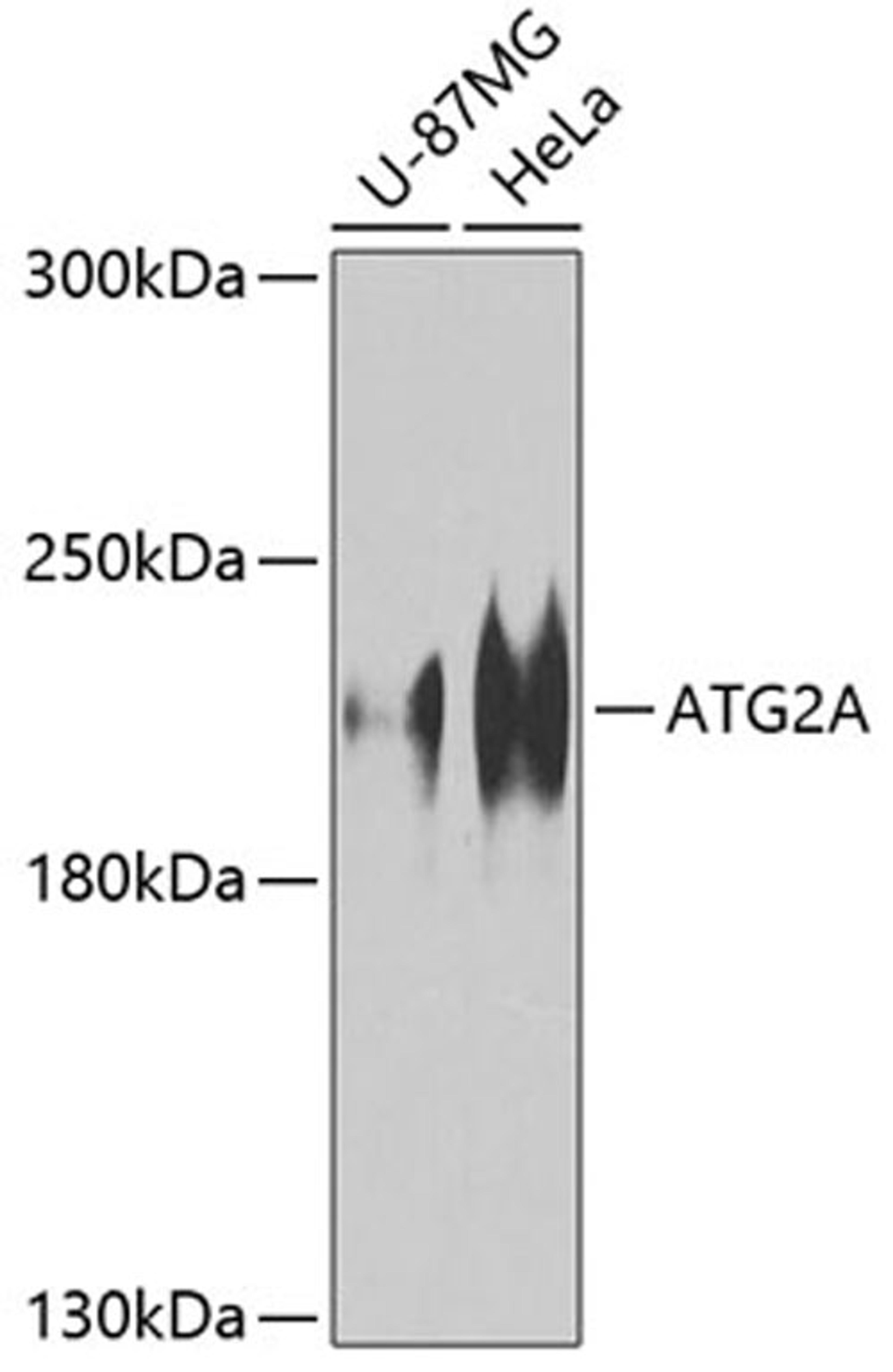 Western blot - ATG2A Antibody (A8576)