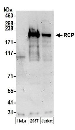 Detection of human RCP by western blot.