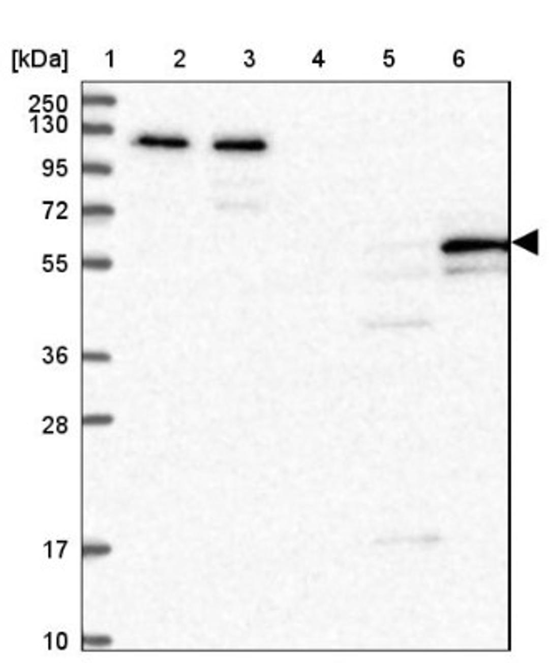 Western Blot: DCAF8L1 Antibody [NBP1-93435] - Lane 1: Marker [kDa] 250, 130, 95, 72, 55, 36, 28, 17, 10<br/>Lane 2: Human cell line RT-4<br/>Lane 3: Human cell line U-251MG sp<br/>Lane 4: Human plasma (IgG/HSA depleted)<br/>Lane 5: Human liver tissue<br/>Lane 6: Human tonsil tissue