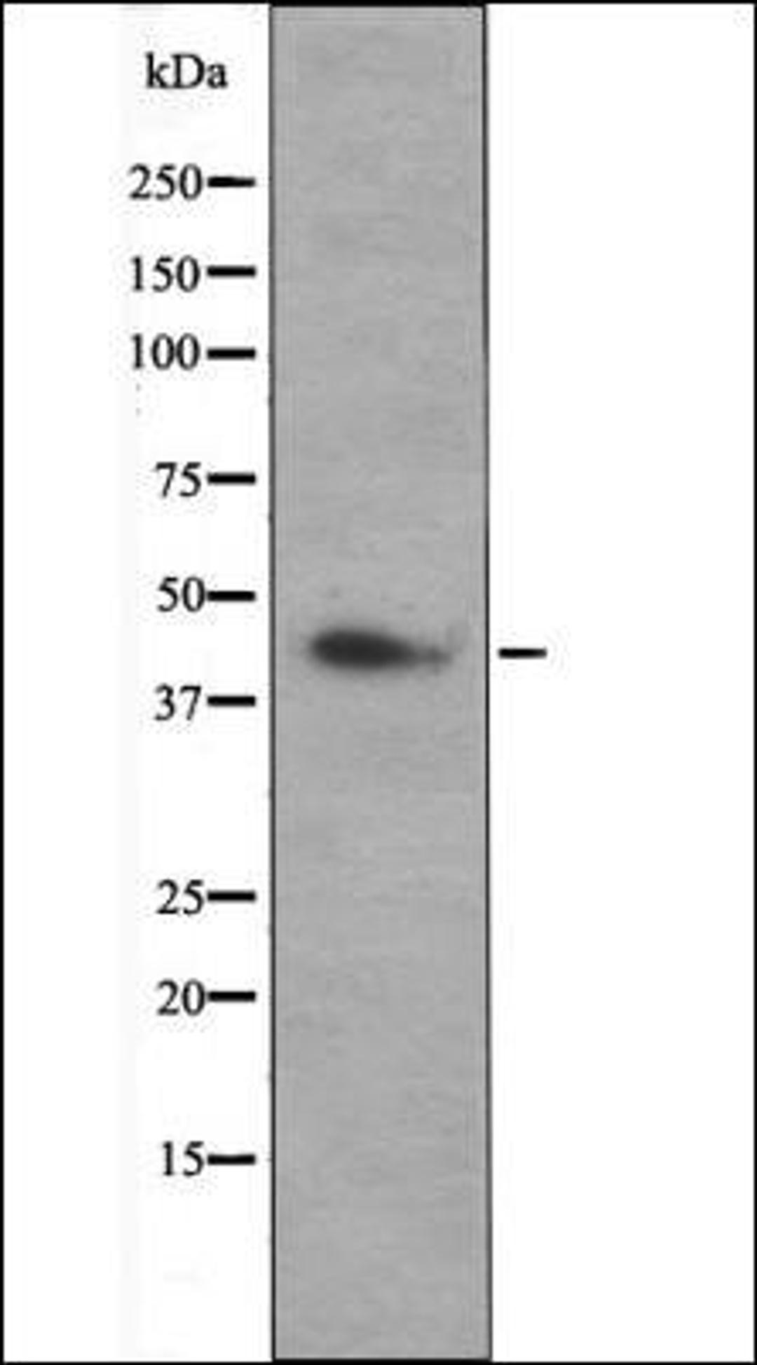 Western blot analysis of Hela whole cell lysates using MEK1/2 -Phospho-Ser217+Ser221- antibody