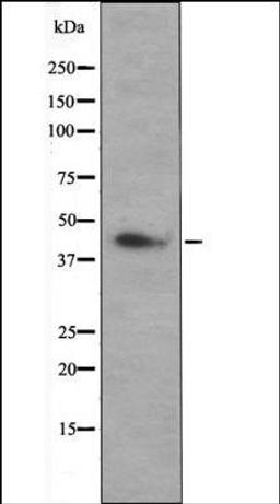 Western blot analysis of Hela whole cell lysates using MEK1/2 -Phospho-Ser217+Ser221- antibody