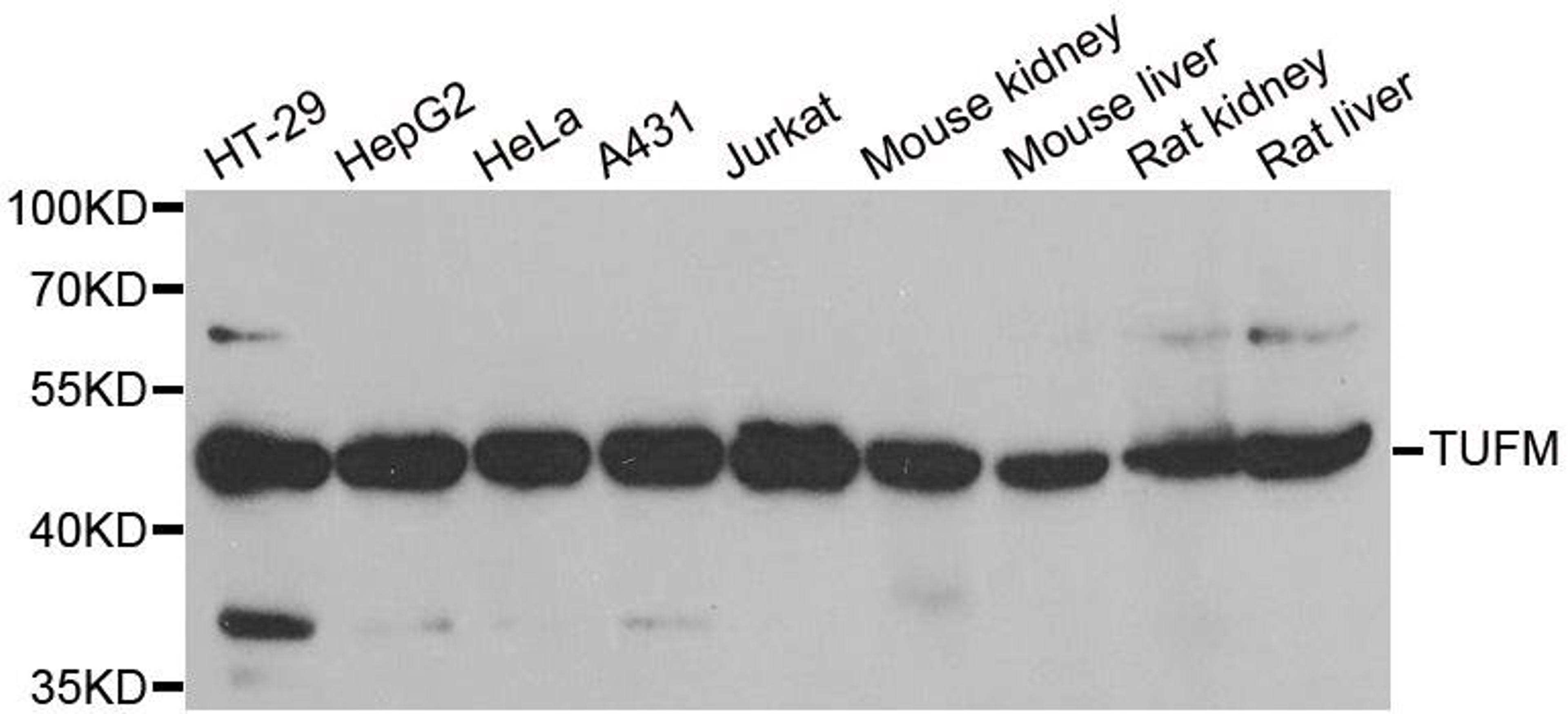 Western blot analysis of extracts of various cell lines using TUFM antibody