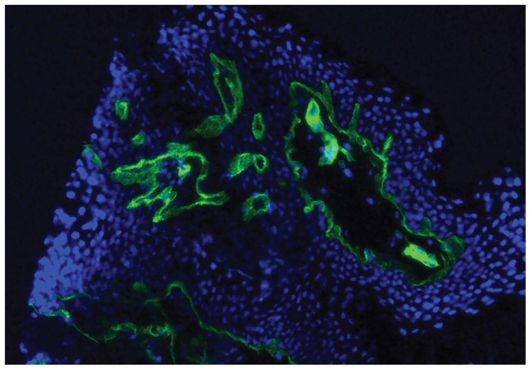 Human skin tissue was stained with Mouse Anti-Type IV Collagen-UNLB (Cat. No. 98-527) followed by Goat Anti-Mouse IgG1, Human ads-AF488 .