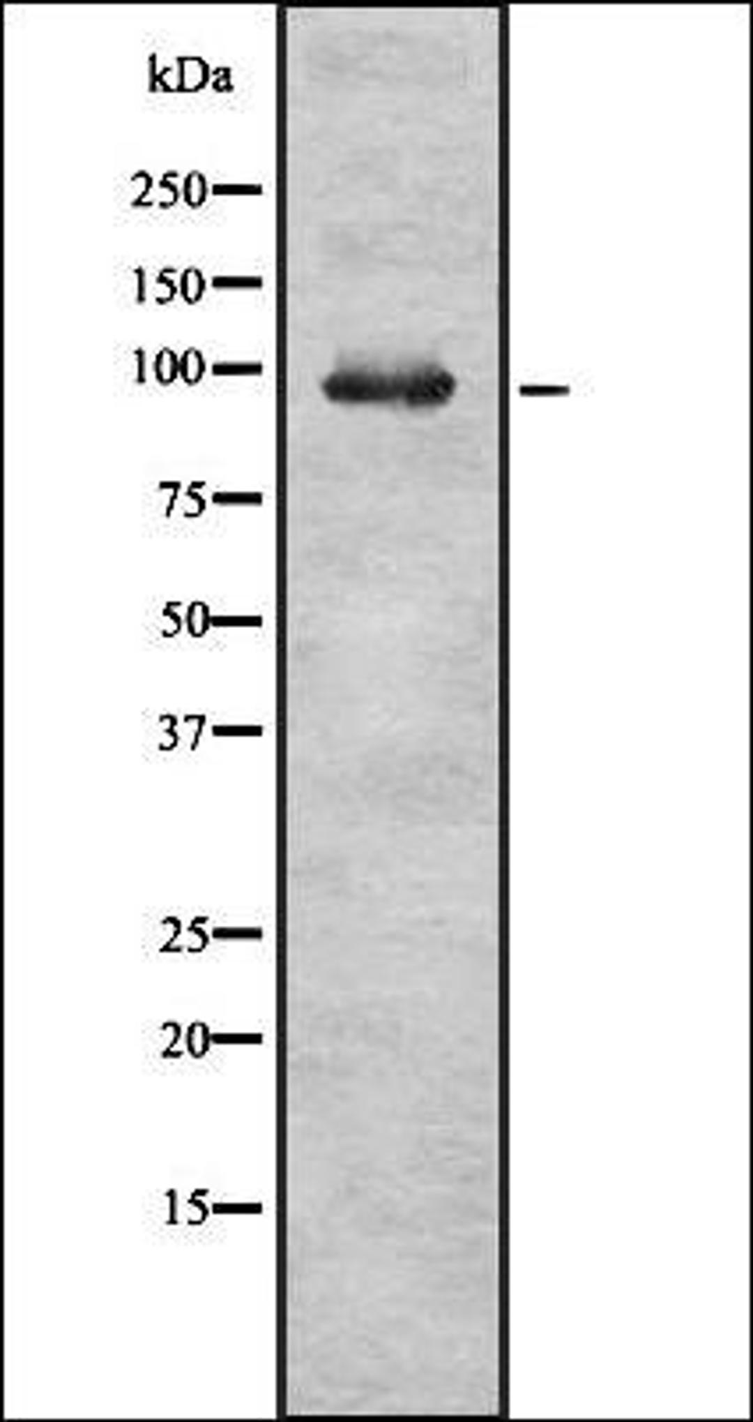 Western blot analysis of HEK293 cells using RASA2 antibody