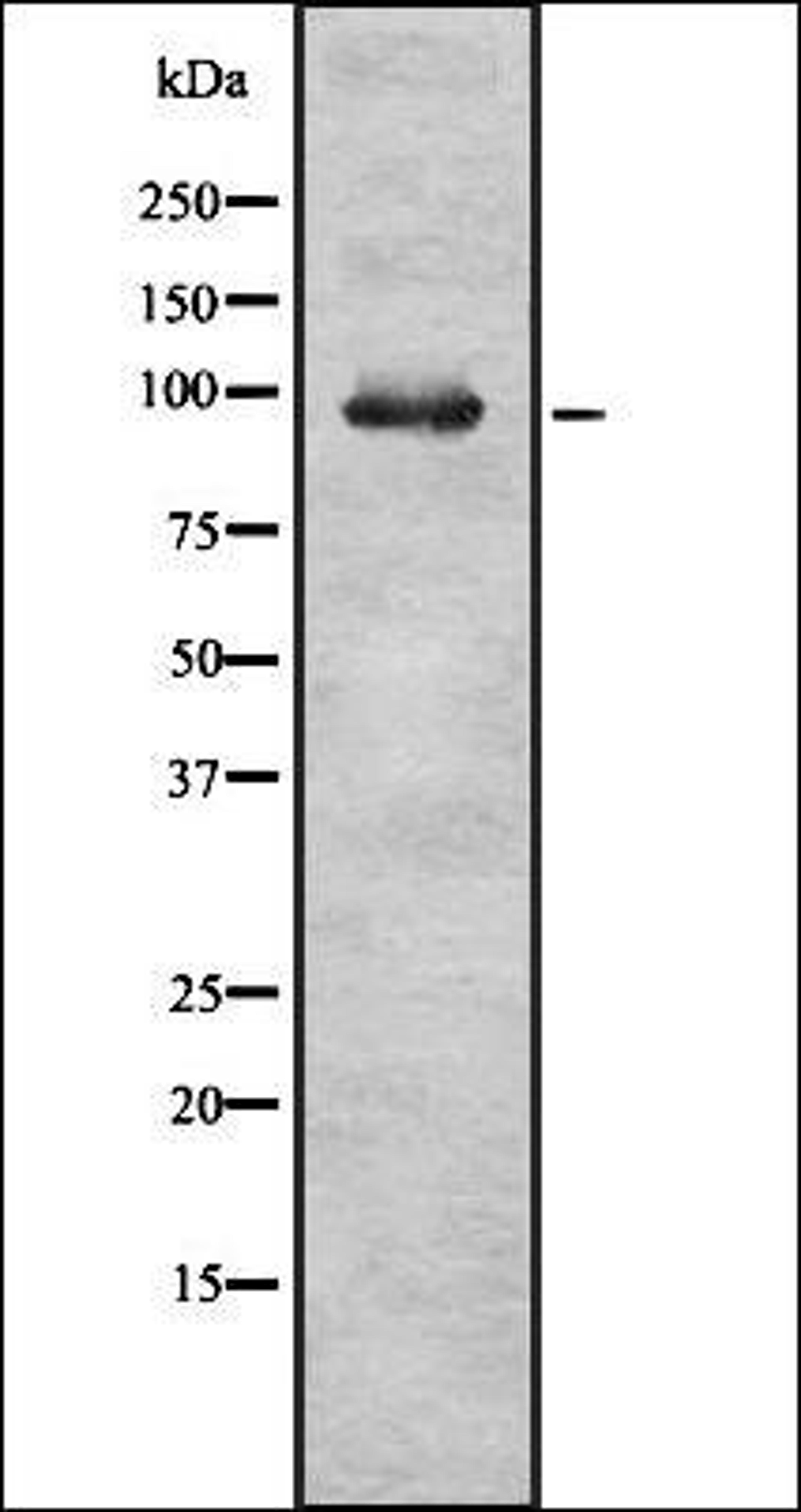 Western blot analysis of HEK293 cells using RASA2 antibody