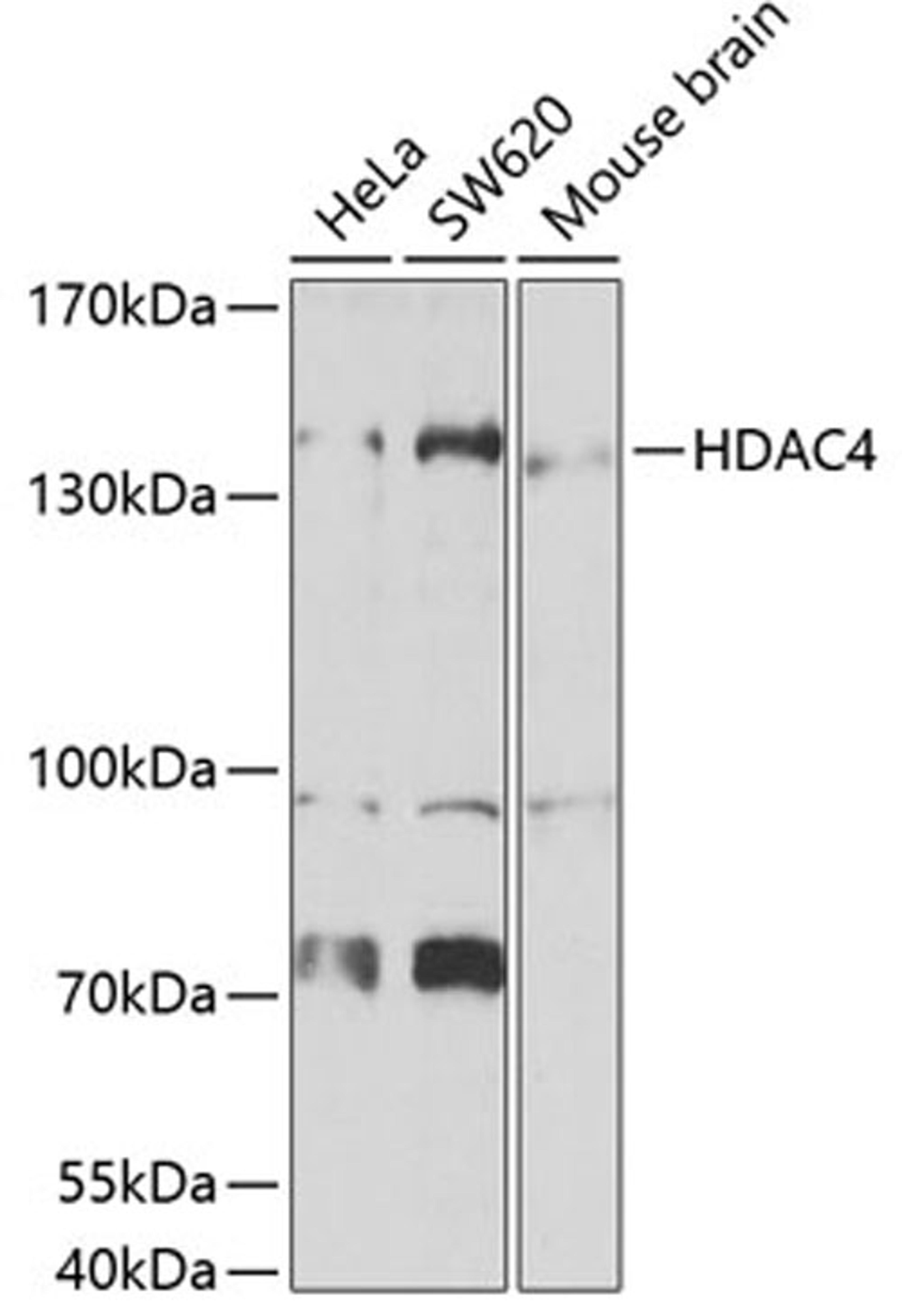 Western blot - HDAC4 antibody (A7951)