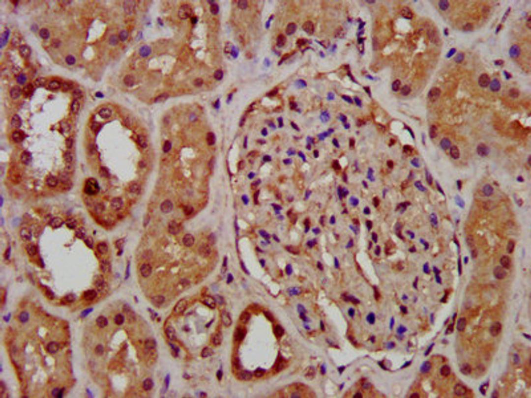 IHC image of CSB-PA863114LA01HU diluted at 1:400 and staining in paraffin-embedded human kidney tissue performed on a Leica BondTM system. After dewaxing and hydration, antigen retrieval was mediated by high pressure in a citrate buffer (pH 6.0). Section was blocked with 10% normal goat serum 30min at RT. Then primary antibody (1% BSA) was incubated at 4&deg;C overnight. The primary is detected by a biotinylated secondary antibody and visualized using an HRP conjugated SP system.