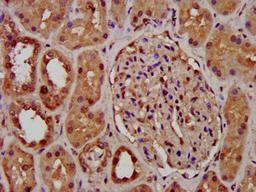 IHC image of CSB-PA863114LA01HU diluted at 1:400 and staining in paraffin-embedded human kidney tissue performed on a Leica BondTM system. After dewaxing and hydration, antigen retrieval was mediated by high pressure in a citrate buffer (pH 6.0). Section was blocked with 10% normal goat serum 30min at RT. Then primary antibody (1% BSA) was incubated at 4&deg;C overnight. The primary is detected by a biotinylated secondary antibody and visualized using an HRP conjugated SP system.
