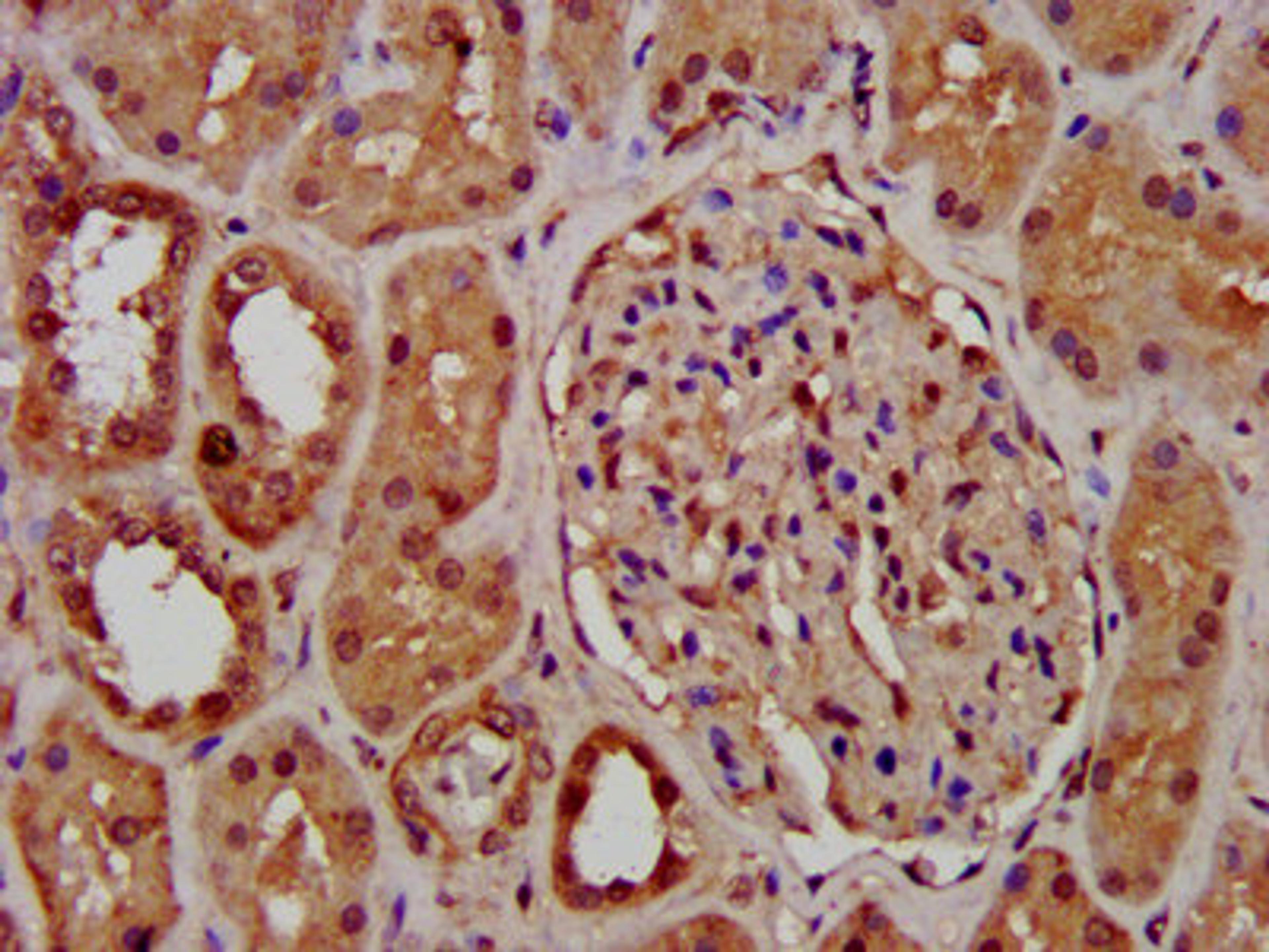 IHC image of CSB-PA863114LA01HU diluted at 1:400 and staining in paraffin-embedded human kidney tissue performed on a Leica BondTM system. After dewaxing and hydration, antigen retrieval was mediated by high pressure in a citrate buffer (pH 6.0). Section was blocked with 10% normal goat serum 30min at RT. Then primary antibody (1% BSA) was incubated at 4&deg;C overnight. The primary is detected by a biotinylated secondary antibody and visualized using an HRP conjugated SP system.