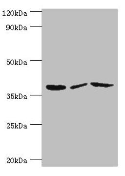 Western blot. All lanes: P2RY14 antibody at 12ug/ml. Lane 1: Mouse heart tissue. Lane 2: Mouse stomach tissue. Lane 3: Mouse small intestine tissue. Secondary. Goat polyclonal to rabbit IgG at 1/10000 dilution. Predicted band size: 39 kDa. Observed band size: 39 kDa. 