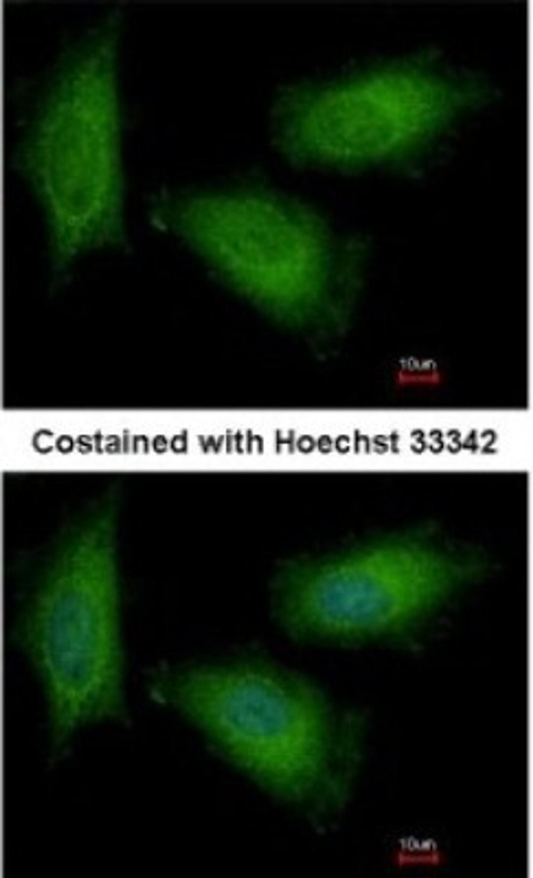 Immunocytochemistry/Immunofluorescence: Triosephosphate isomerase Antibody [NBP1-31470] - Paraformaldehyde-fixed HeLa, using antibody at 1:500 dilution.