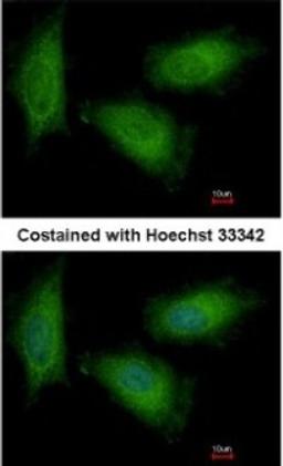 Immunocytochemistry/Immunofluorescence: Triosephosphate isomerase Antibody [NBP1-31470] - Paraformaldehyde-fixed HeLa, using antibody at 1:500 dilution.