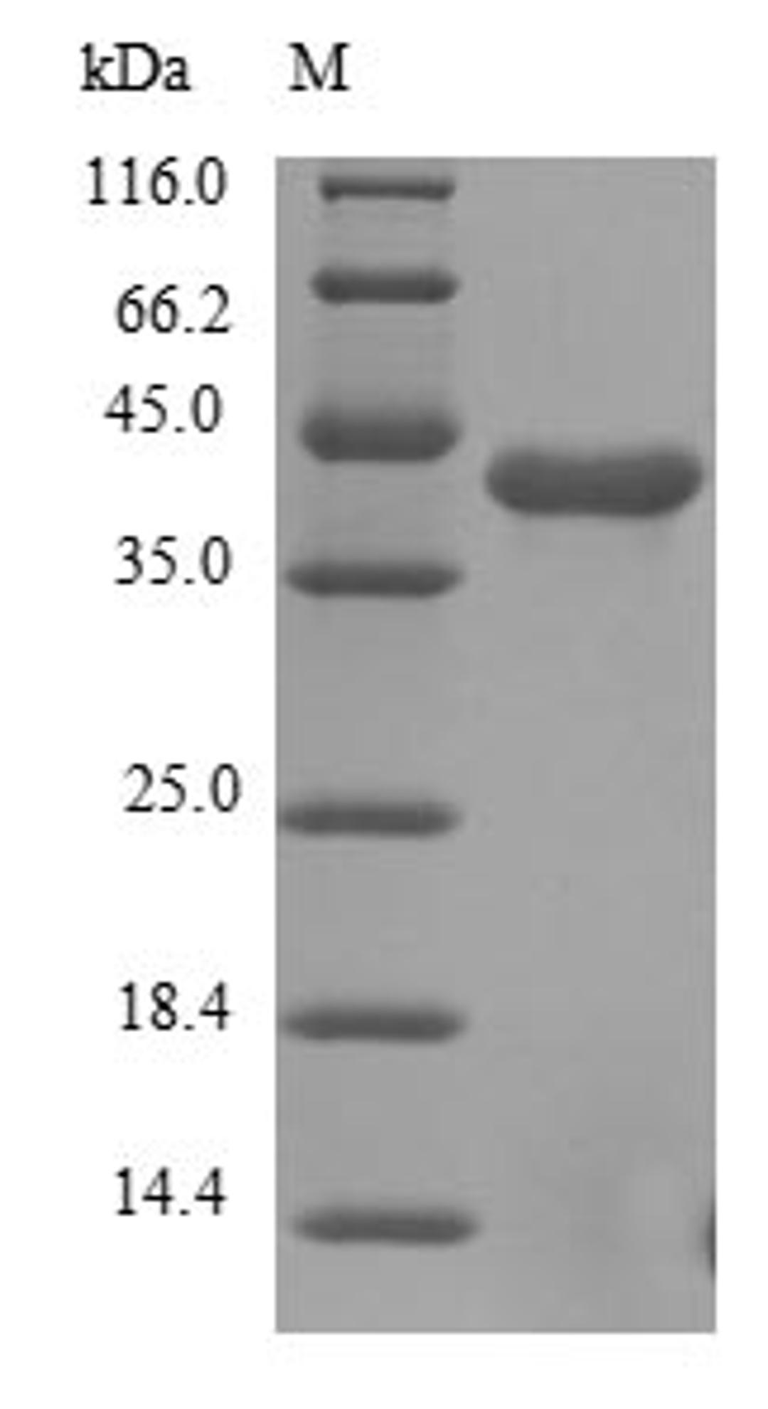 (Tris-Glycine gel) Discontinuous SDS-PAGE (reduced) with 5% enrichment gel and 15% separation gel.