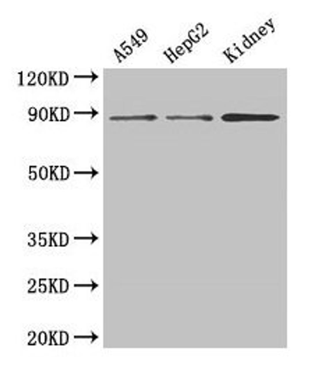 Western Blot. Positive WB detected in: A549 whole cell lysate, HepG2 whole cell lysate, Mouse kidney tissue. All lanes: ASPH antibody at 3µg/ml. Secondary. Goat polyclonal to rabbit IgG at 1/50000 dilution. Predicted band size: 86, 35, 26, 24, 34, 84, 30, 22, 29, 33 kDa. Observed band size: 86 kDa