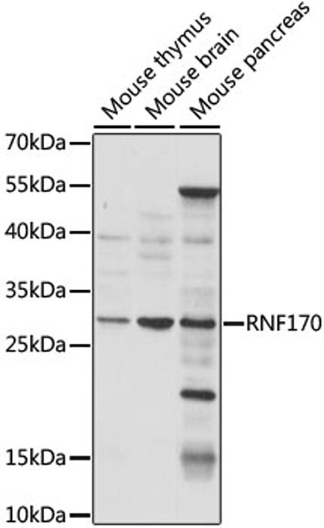 Western blot - RNF170 antibody (A15195)