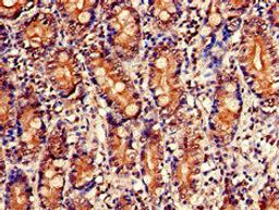 Immunohistochemistry of paraffin-embedded human small intestine tissue using CSB-PA016154LA01HU at dilution of 1:100