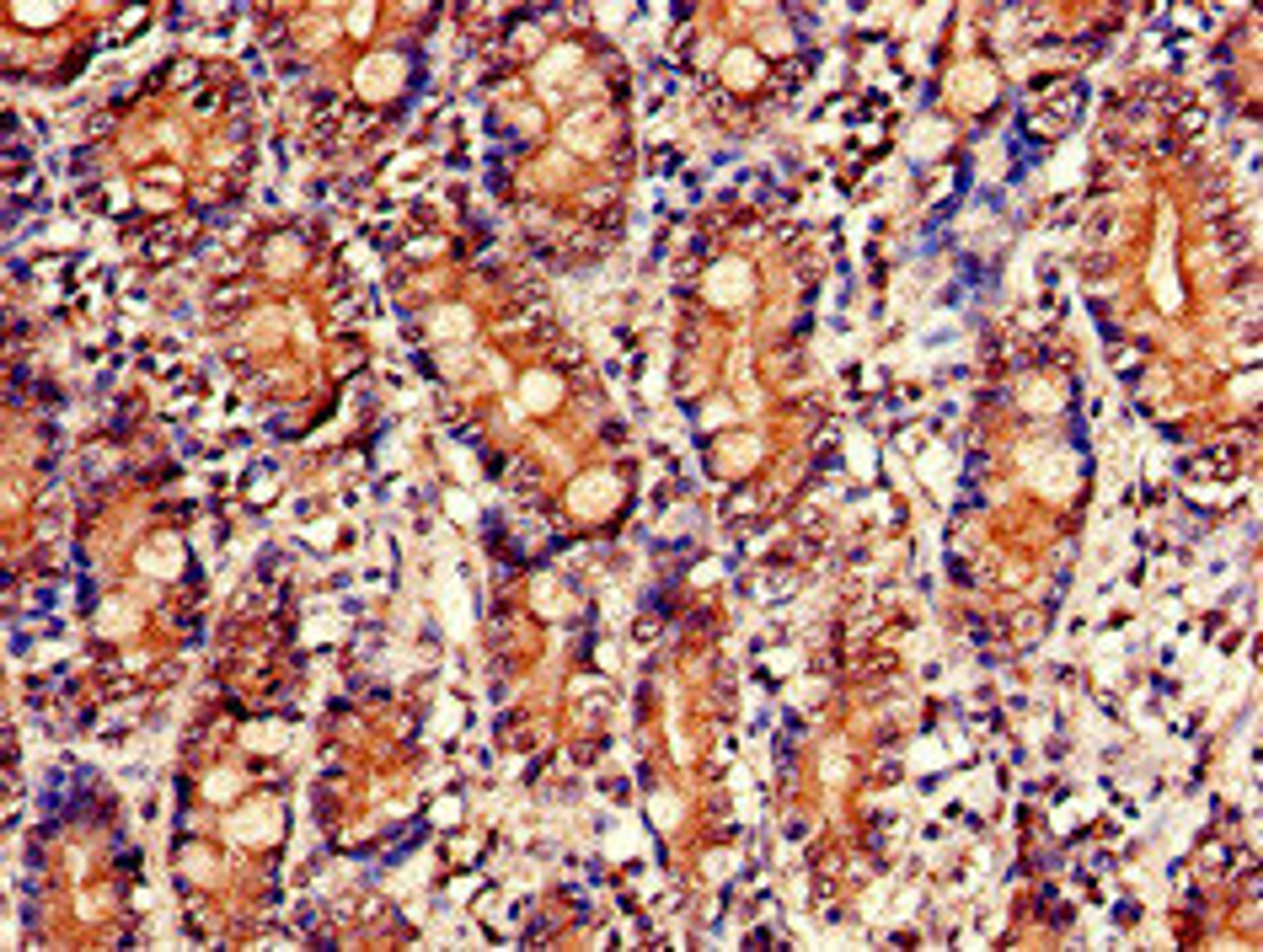 Immunohistochemistry of paraffin-embedded human small intestine tissue using CSB-PA016154LA01HU at dilution of 1:100