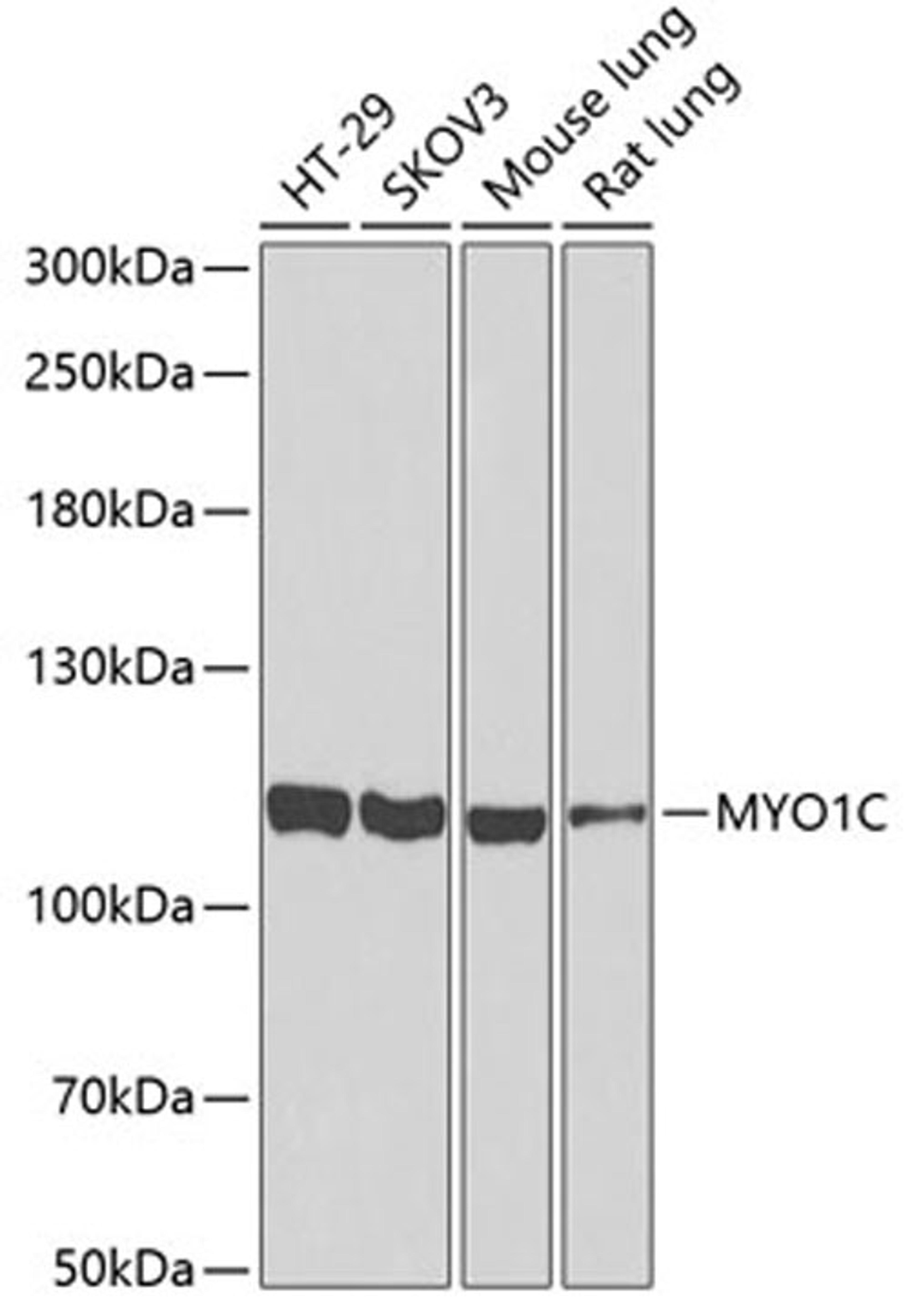 Western blot - MYO1C antibody (A6936)