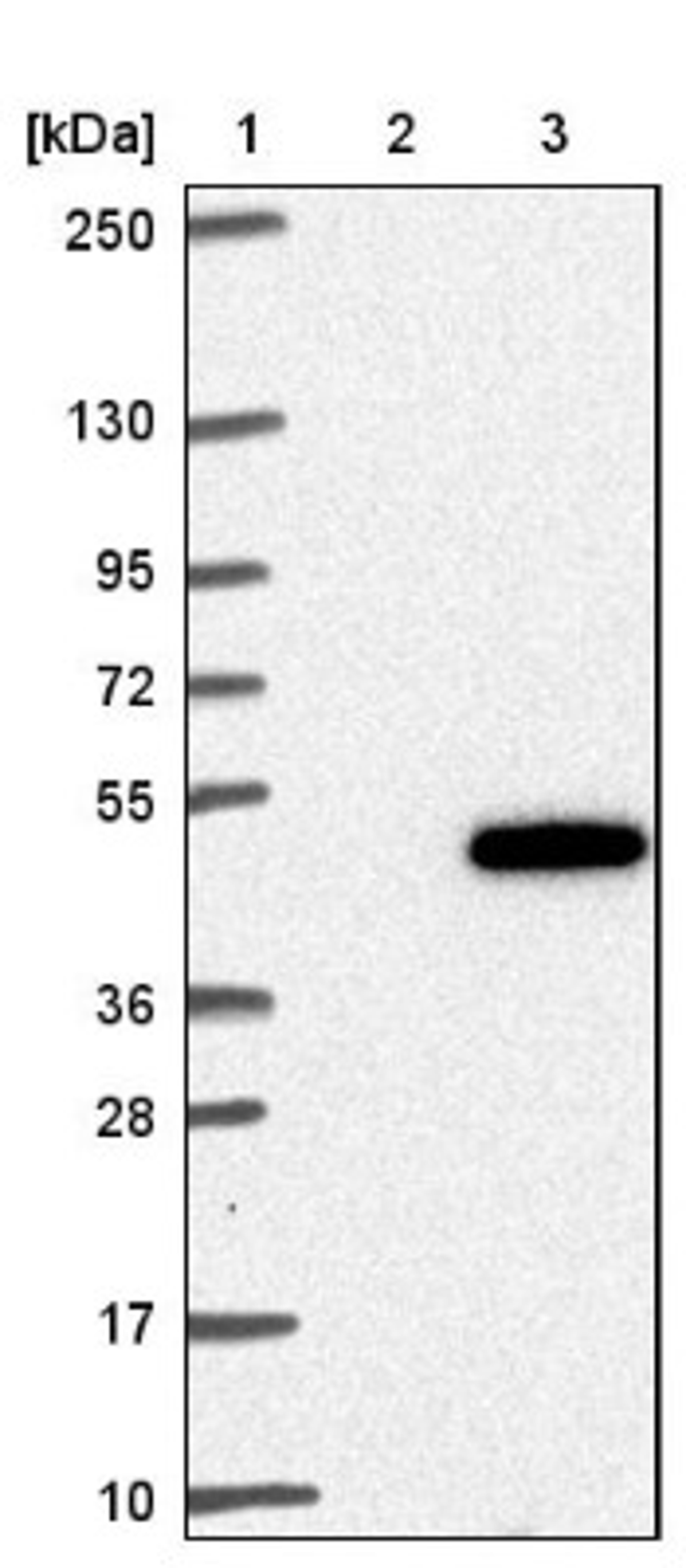 Western Blot: ZNF843 Antibody [NBP1-93468] - Lane 1: Marker [kDa] 250, 130, 95, 72, 55, 36, 28, 17, 10<br/>Lane 2: Negative control (vector only transfected HEK293T lysate)<br/>Lane 3: Over-expression lysate (Co-expressed with a C-terminal myc-DDK tag (~3.1 kDa) in mammalian HEK293T cells, LY403727)