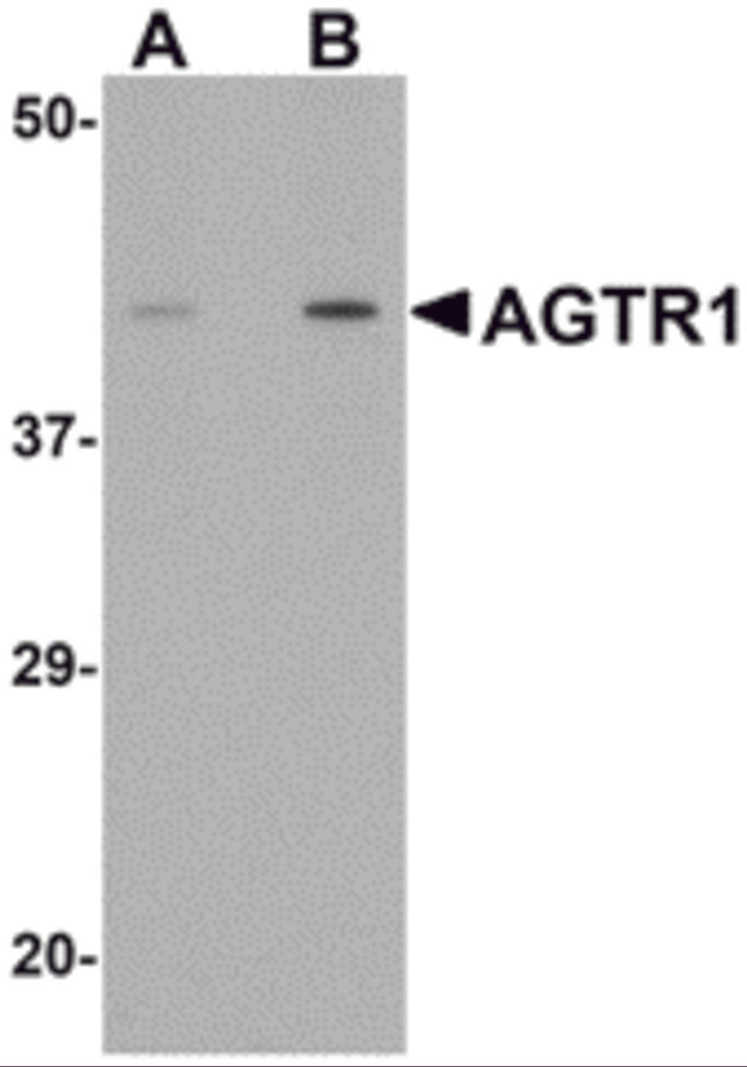 Western blot analysis of AGTR1 in mouse kidney tissue lysate with AGTR1 antibody at (A) 1 and (B) 2 &#956;g/mL.