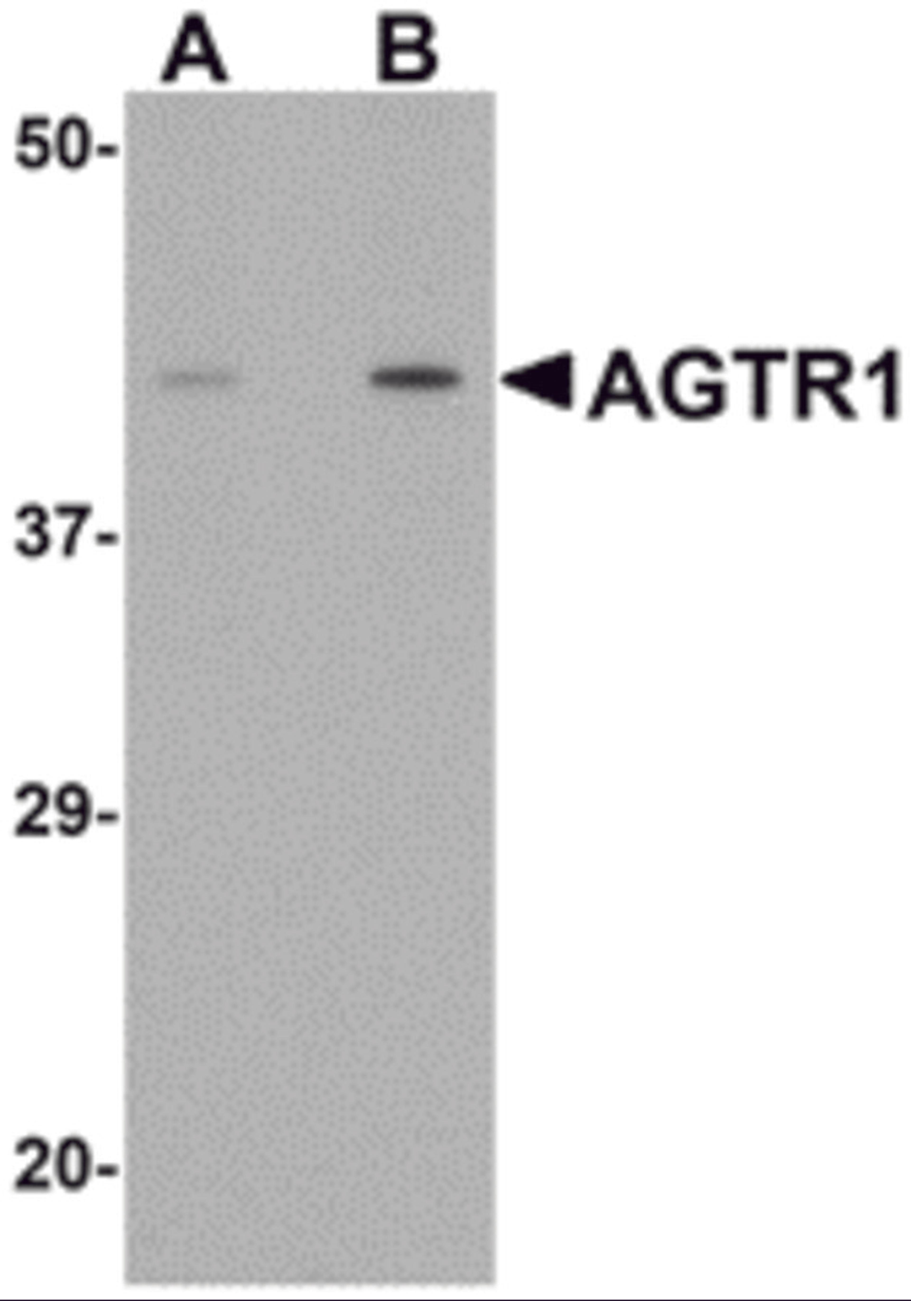 Western blot analysis of AGTR1 in mouse kidney tissue lysate with AGTR1 antibody at (A) 1 and (B) 2 μg/mL.