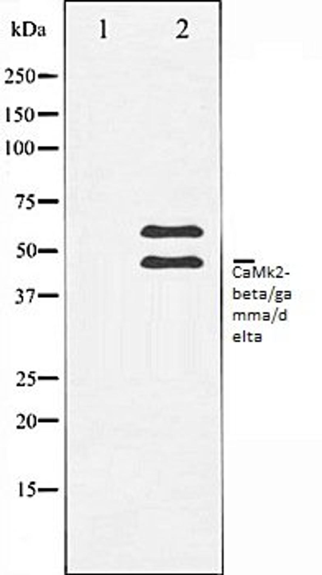 Western blot analysis of Rat brain tissue lysates using CaMK2-beta/gamma/delta antibody, The lane on the left is treated with the antigen-specific peptide.