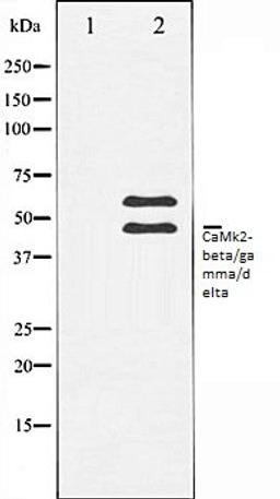 Western blot analysis of Rat brain tissue lysates using CaMK2-beta/gamma/delta antibody, The lane on the left is treated with the antigen-specific peptide.