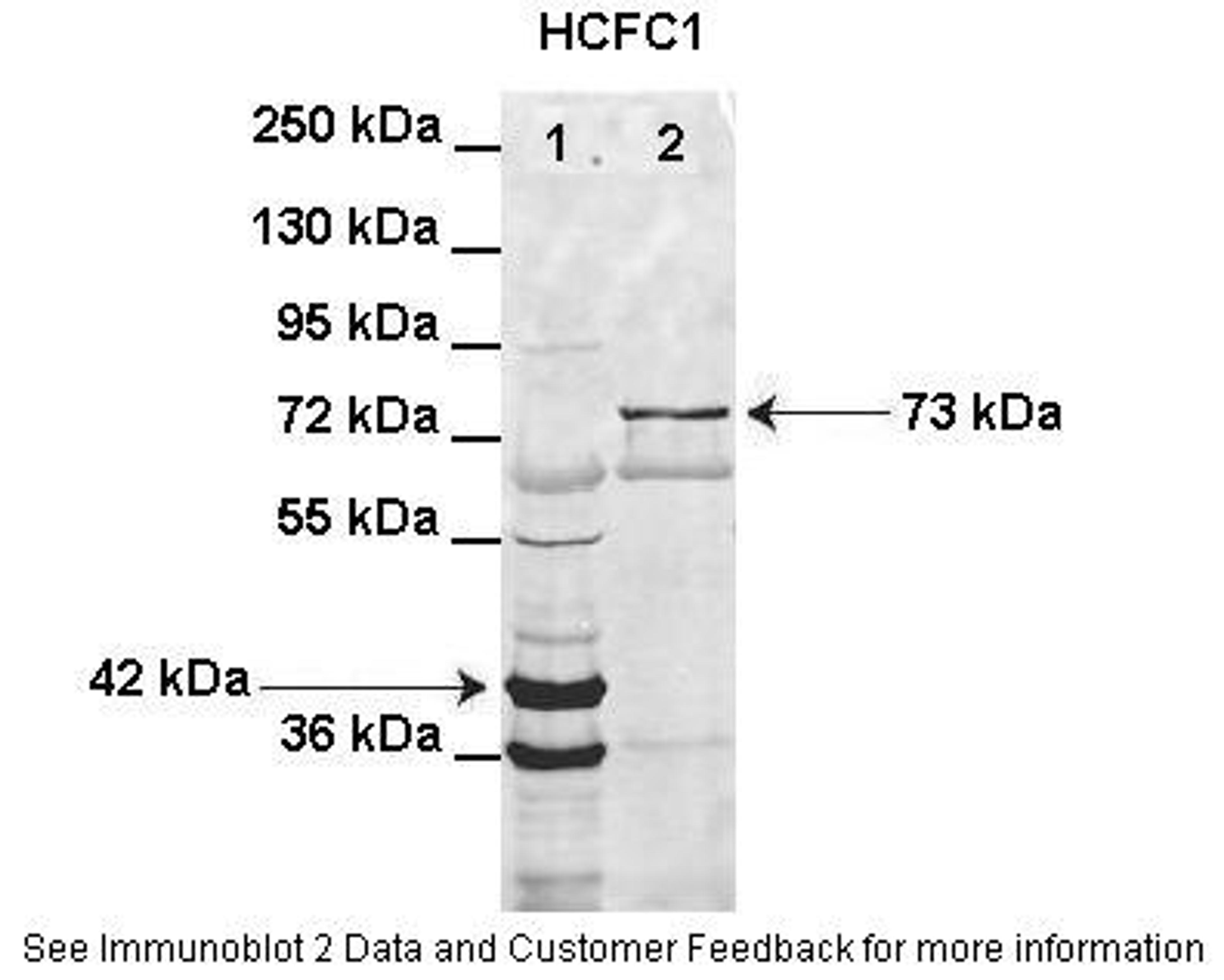 Antibody used in WB on transformed bacteria at: 1:1000 (Lane1: HIS-HCFC1 16-363aa (42kD) transformed bacteria lysate, Lane2: GFP-HCFC1 363-2002aa (73kD) transformed bacteria lysate elution sample).