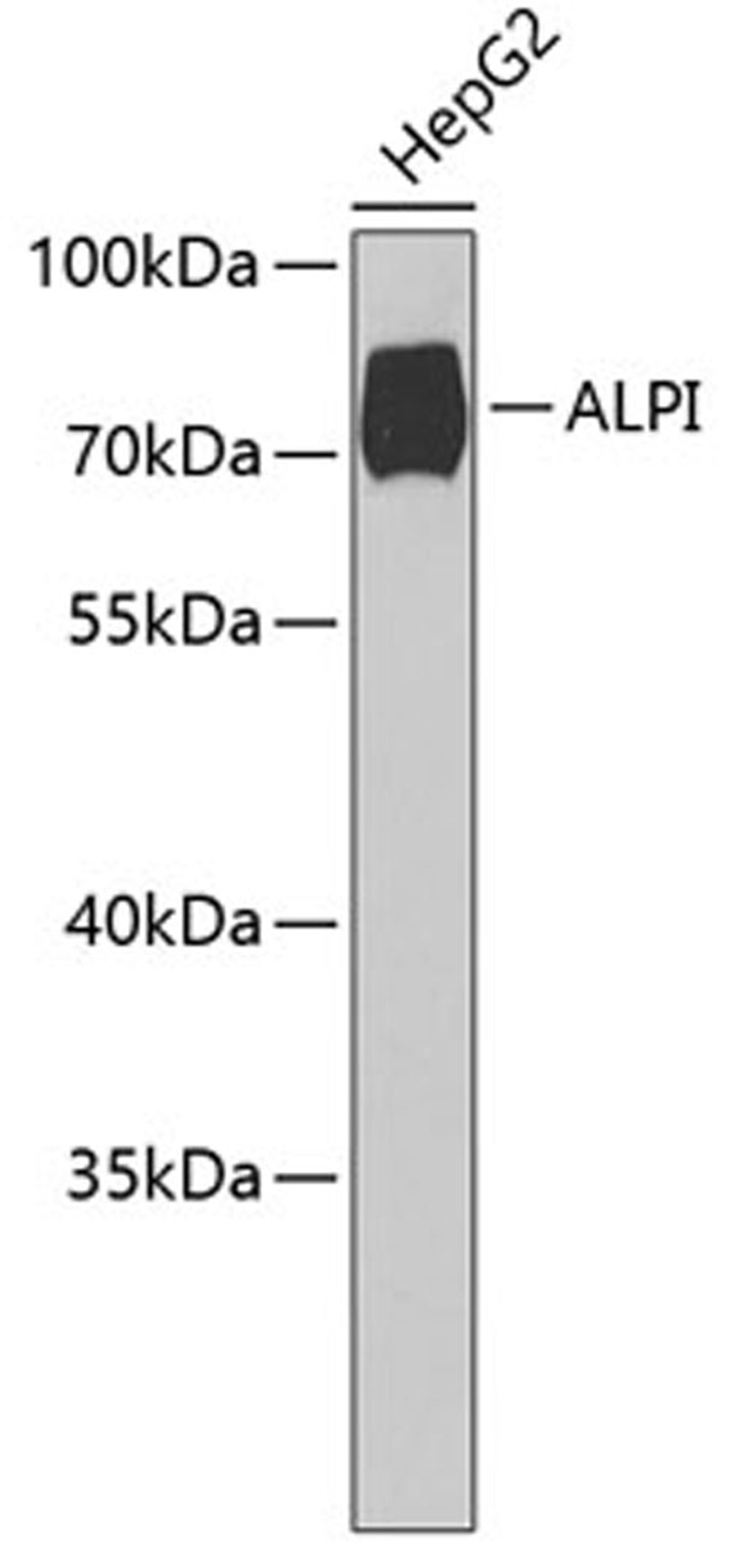 Western blot - ALPI Antibody (A6226)