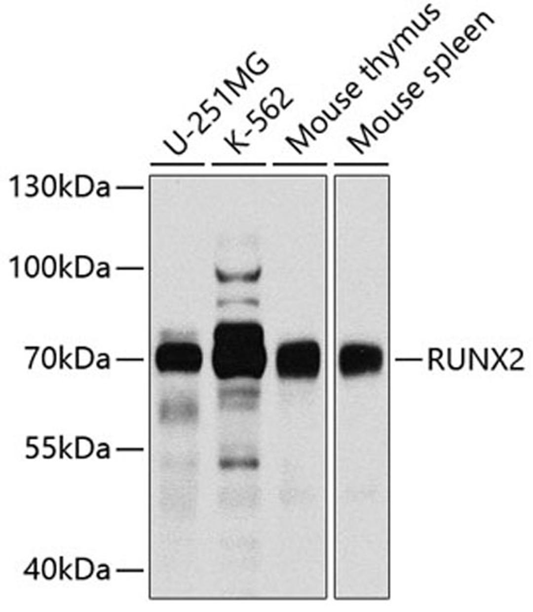 Western blot - RUNX2 antibody (A2851)