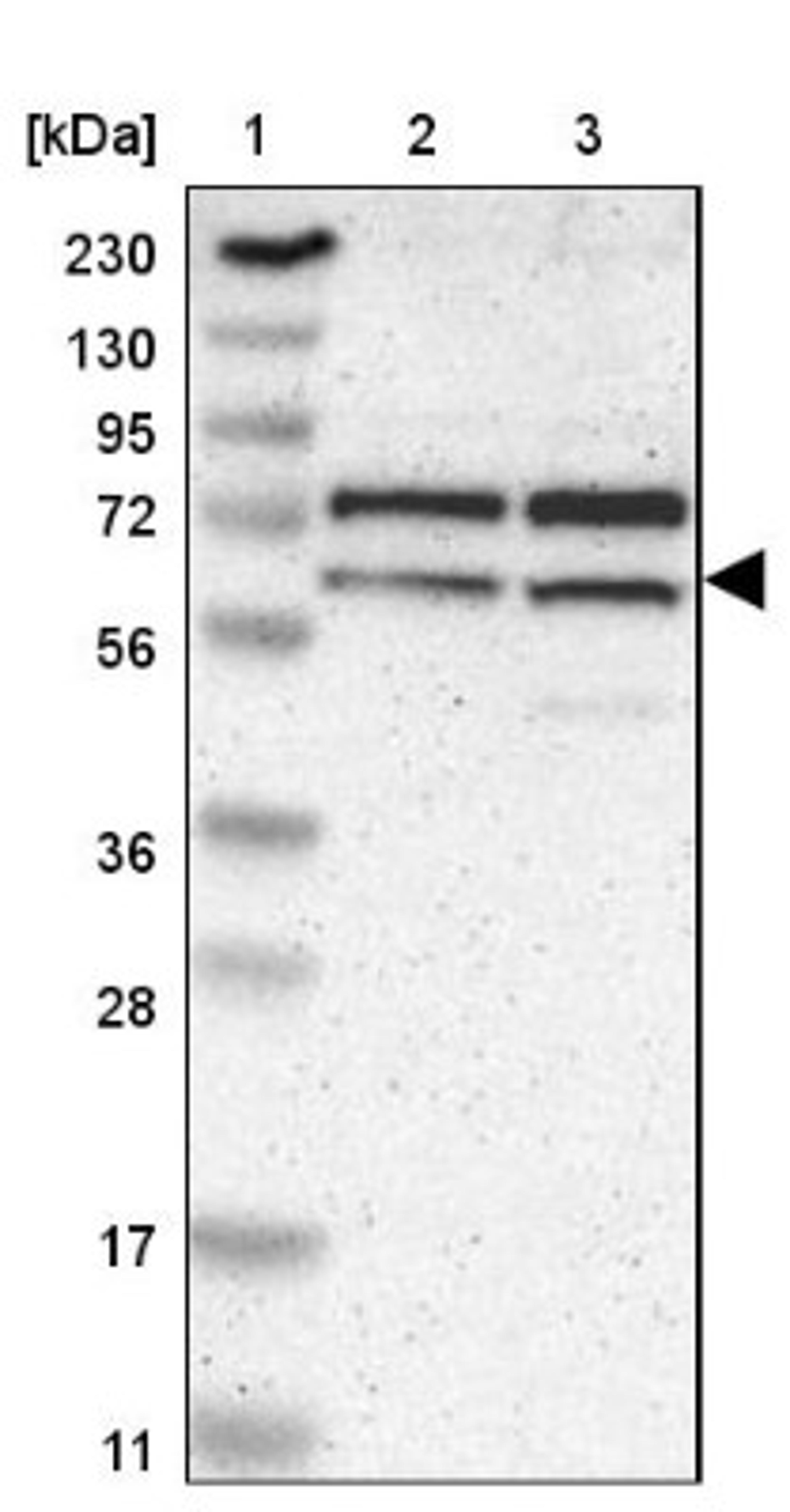 Western Blot: ZKSCAN1 Antibody [NBP1-81346] - Lane 1: Marker [kDa] 230, 130, 95, 72, 56, 36, 28, 17, 11<br/>Lane 2: Human cell line RT-4<br/>Lane 3: Human cell line U-251MG sp