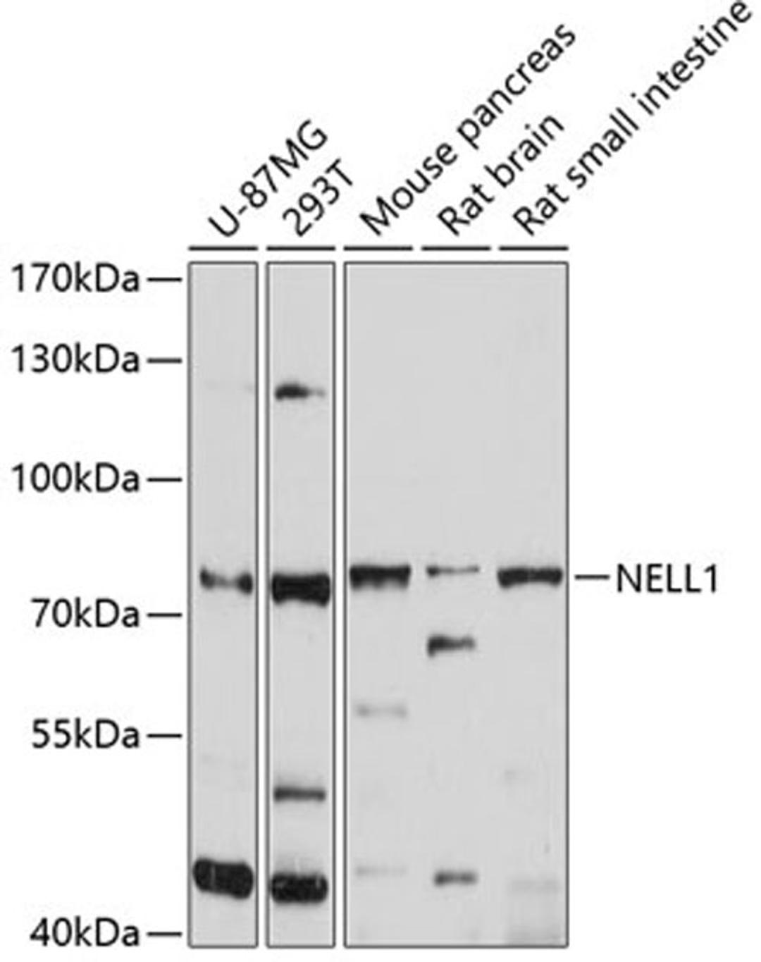 Western blot - NELL1 antibody (A10358)