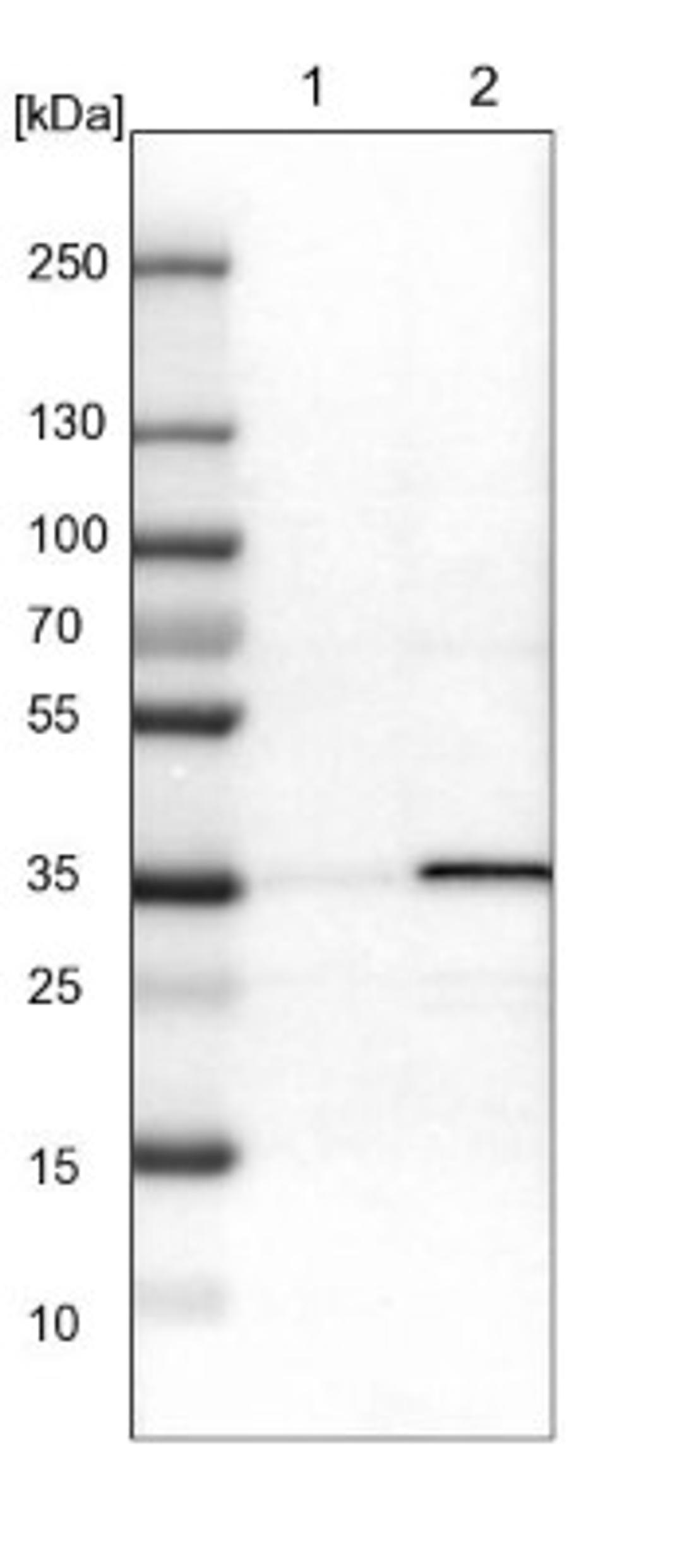 Western Blot: ADP-Sugar Pyrophosphatase/NUDT5 Antibody [NBP1-83131] - Lane 1: NIH-3T3 cell lysate (Mouse embryonic fibroblast cells)<br/>Lane 2: NBT-II cell lysate (Rat Wistar bladder tumour cells)