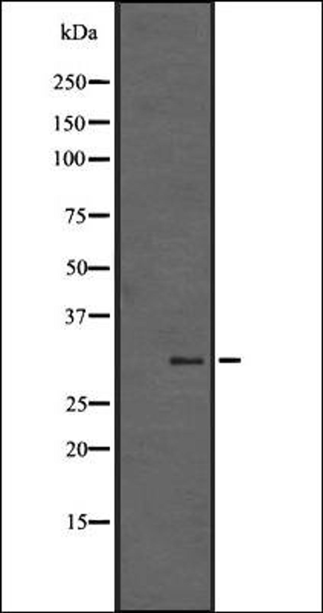 Western blot analysis of A431 whole cell lysate using SGK494 antibody