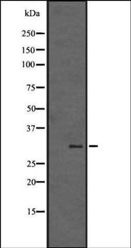 Western blot analysis of A431 whole cell lysate using SGK494 antibody