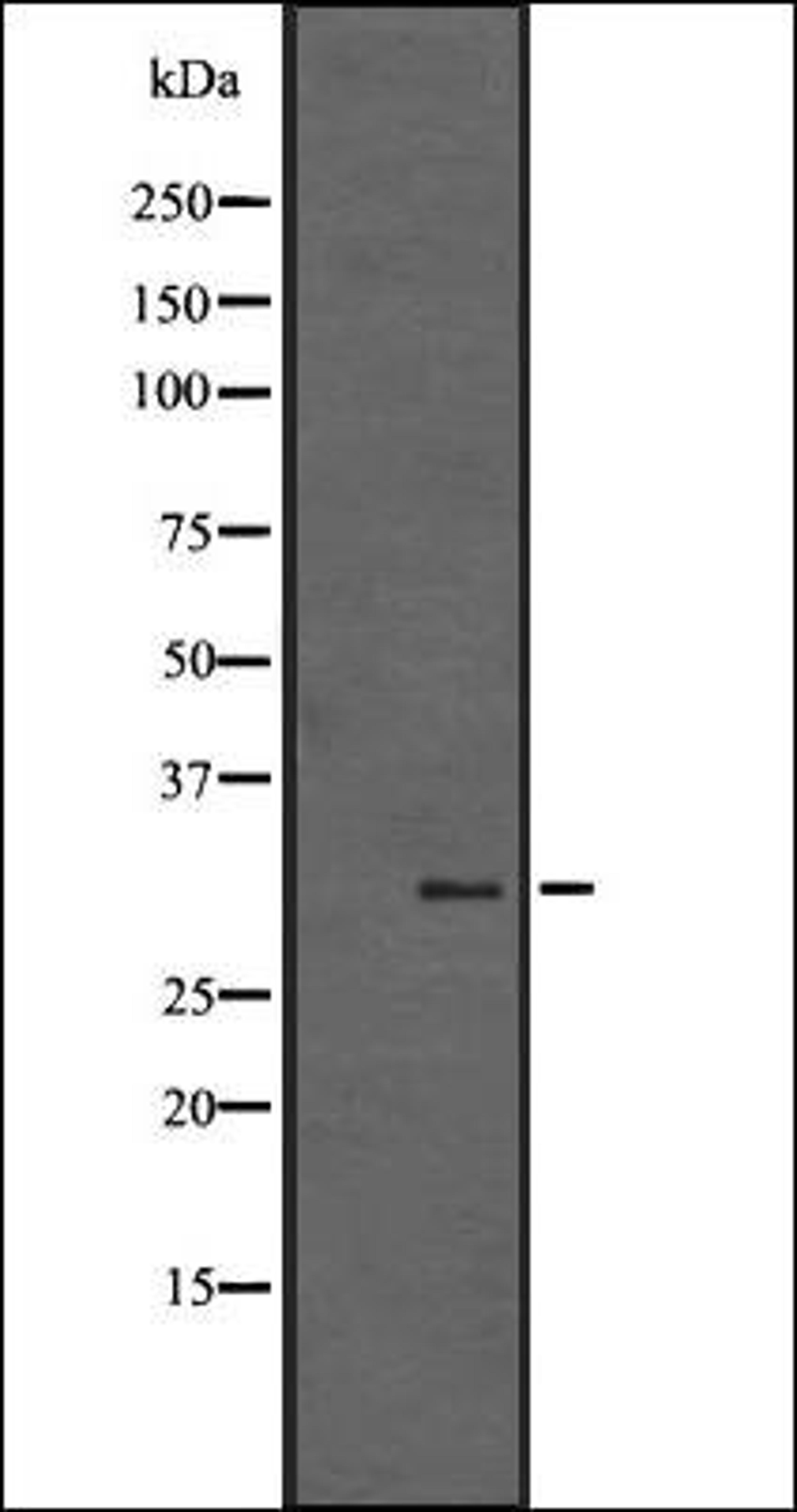 Western blot analysis of A431 whole cell lysate using SGK494 antibody