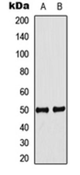 Western blot analysis of MCF7 (Lane1), mouse heart (Lane2) whole cell using IDOL antibody