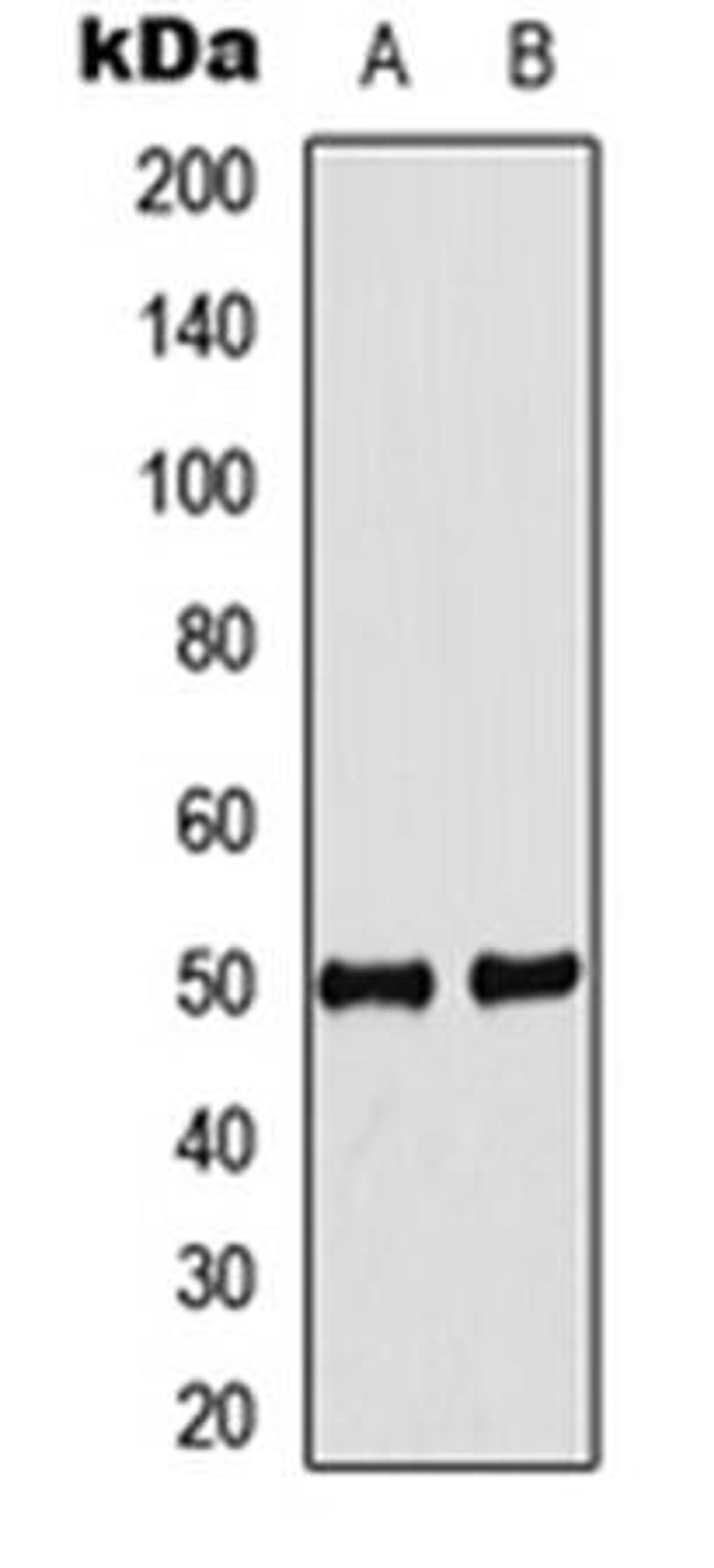 Western blot analysis of MCF7 (Lane1), mouse heart (Lane2) whole cell using IDOL antibody