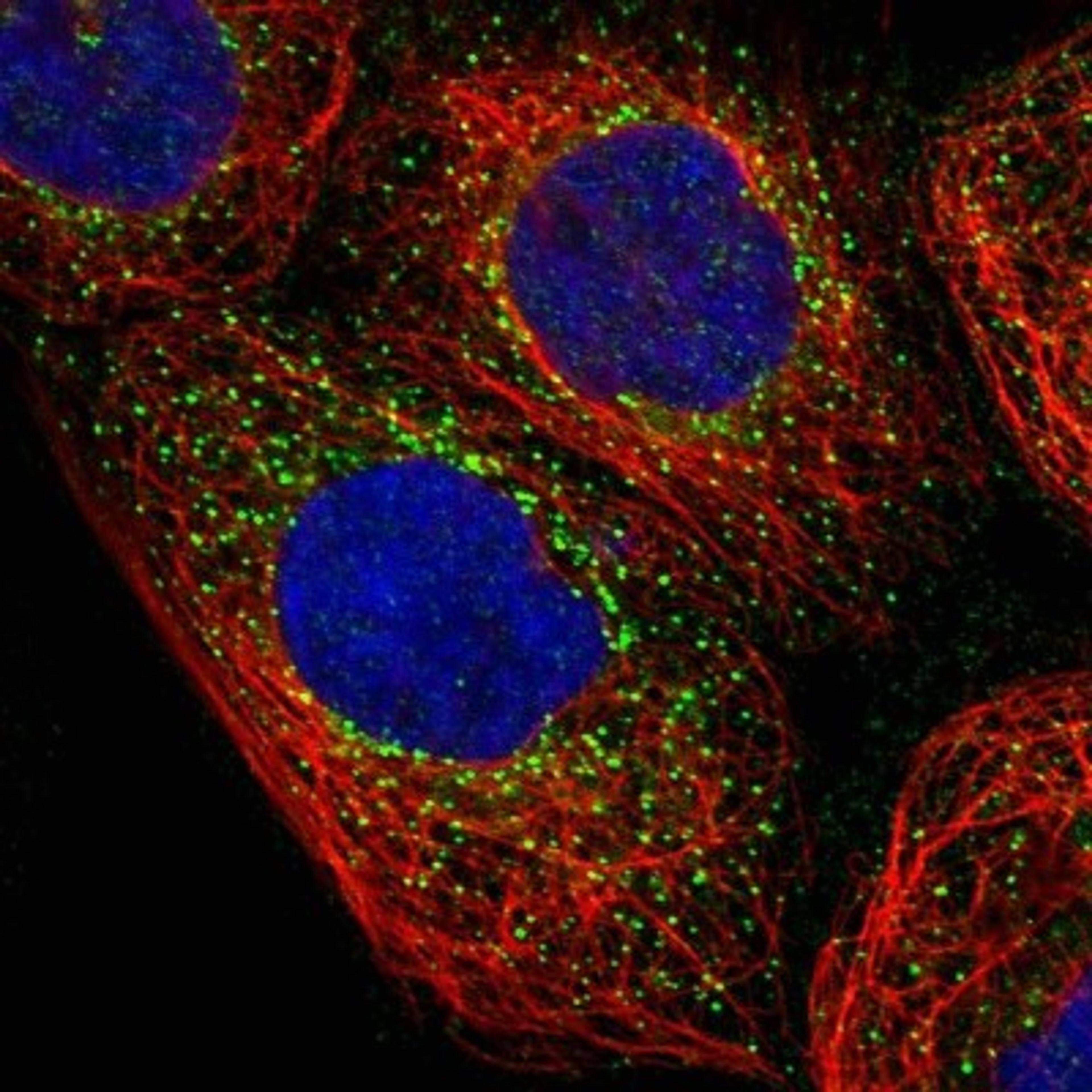 Immunocytochemistry/Immunofluorescence: NME6 Antibody [NBP1-81587] - Staining of human cell line A-431 shows positivity in vesicles.