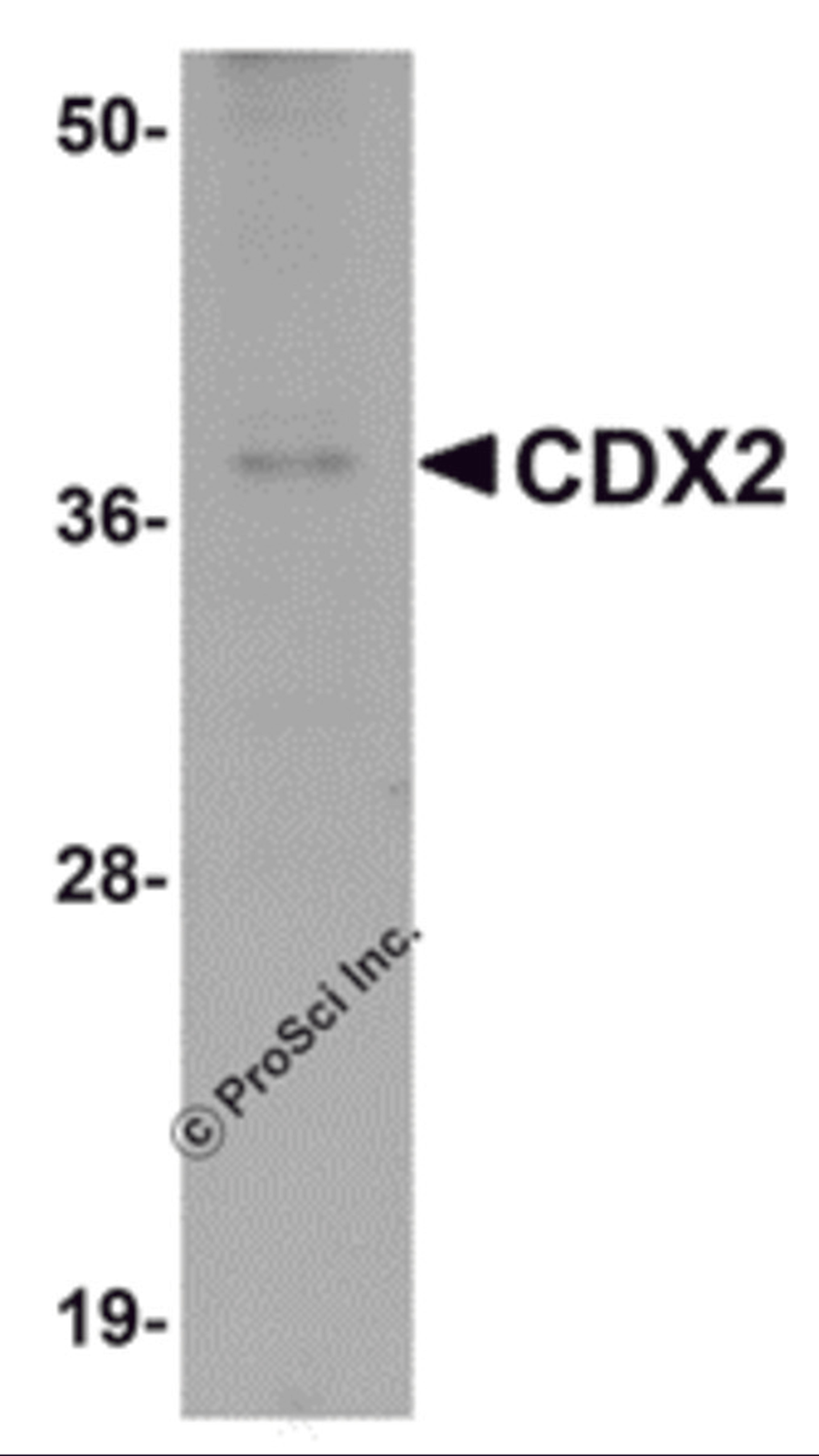 Western blot analysis of CDX2 in mouse brain tissue lysate with CDX2 antibody at 1 &#956;g/mL.