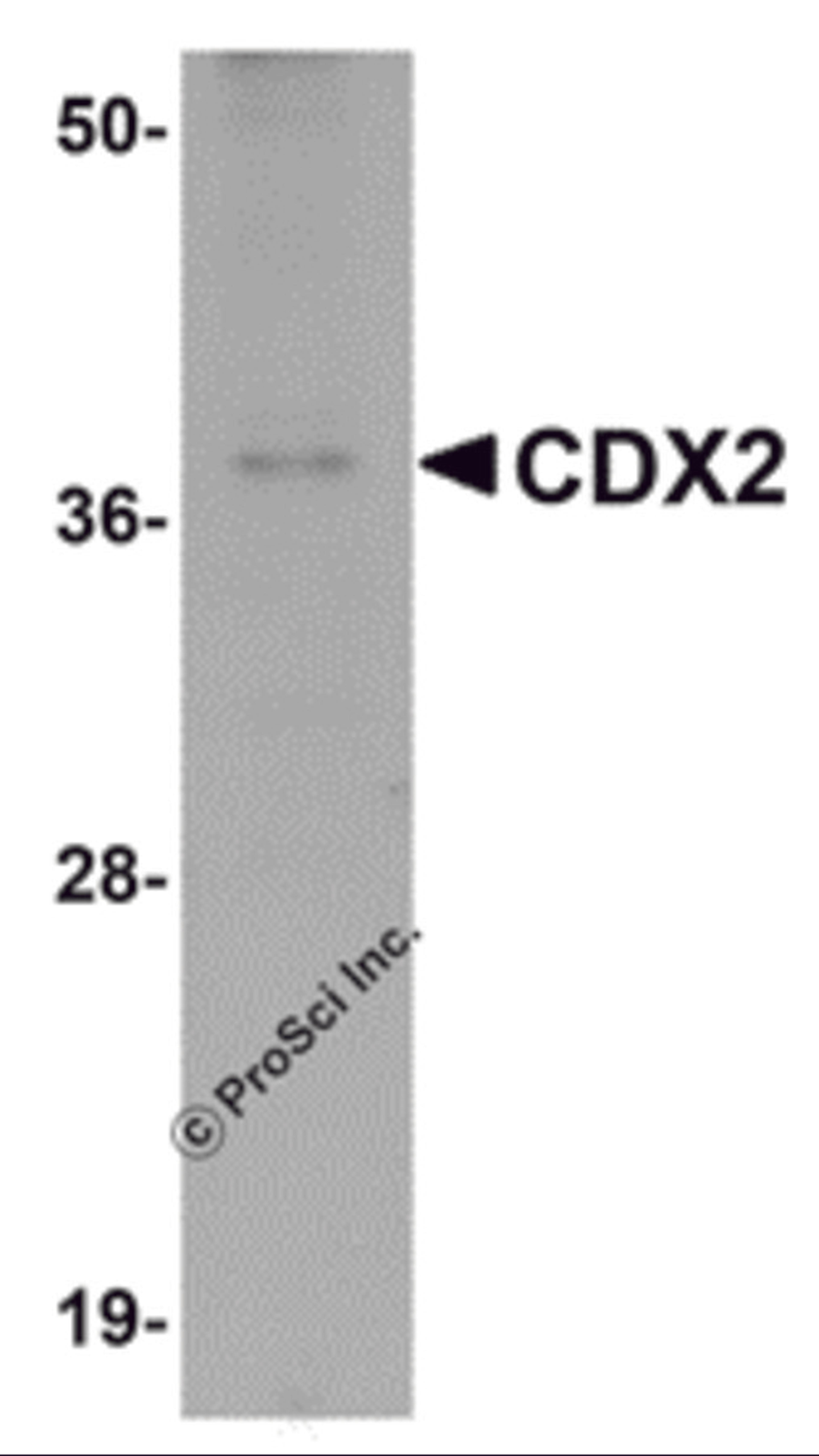Western blot analysis of CDX2 in mouse brain tissue lysate with CDX2 antibody at 1 μg/mL.